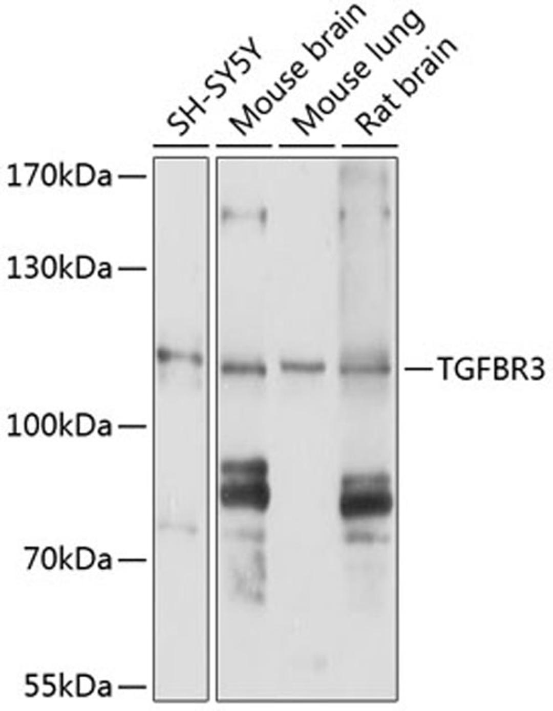 Western blot - TGFBR3 antibody (A0627)