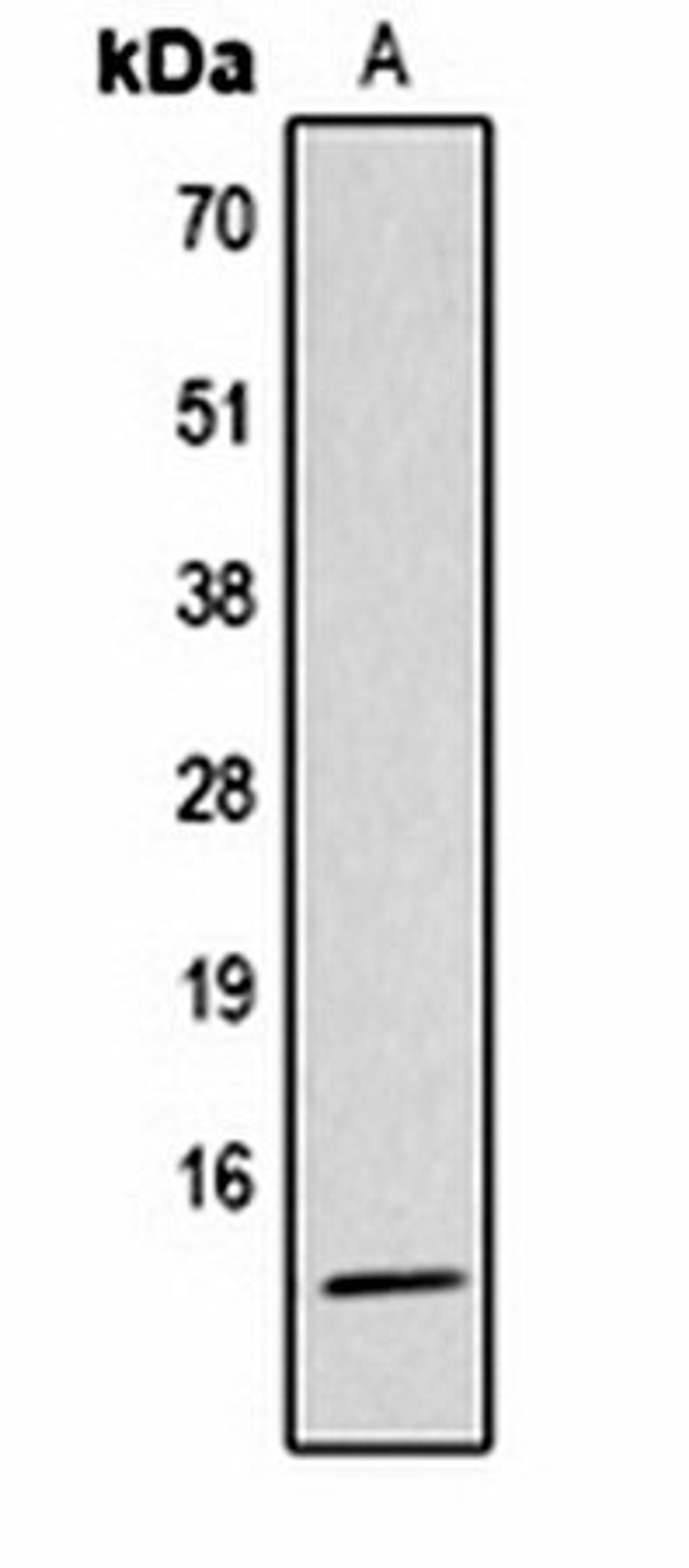 Western blot analysis of  Hela TSA-treated (Lane1) whole cell lysates using Histone H4 (AcK5) antibody