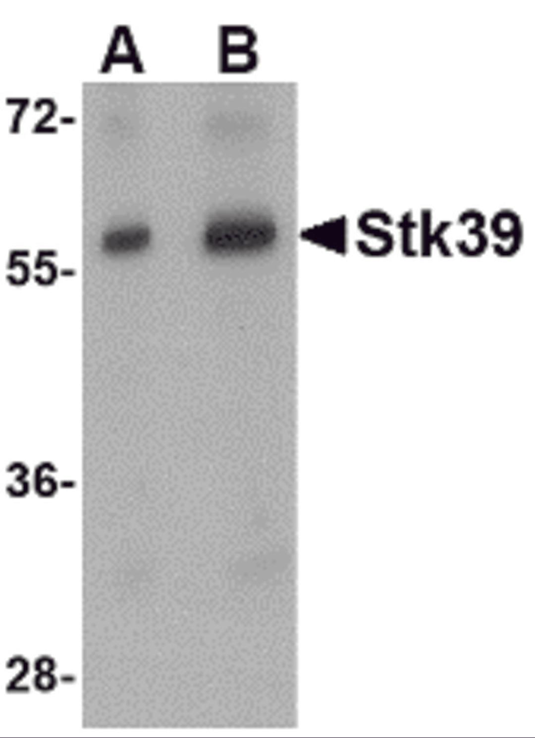 Western blot analysis of Stk39 in rat brain tissue lysate with Stk39 antibody at (A) 1 and (B) 2 μg/mL.
