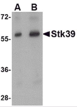 Western blot analysis of Stk39 in rat brain tissue lysate with Stk39 antibody at (A) 1 and (B) 2 μg/mL.