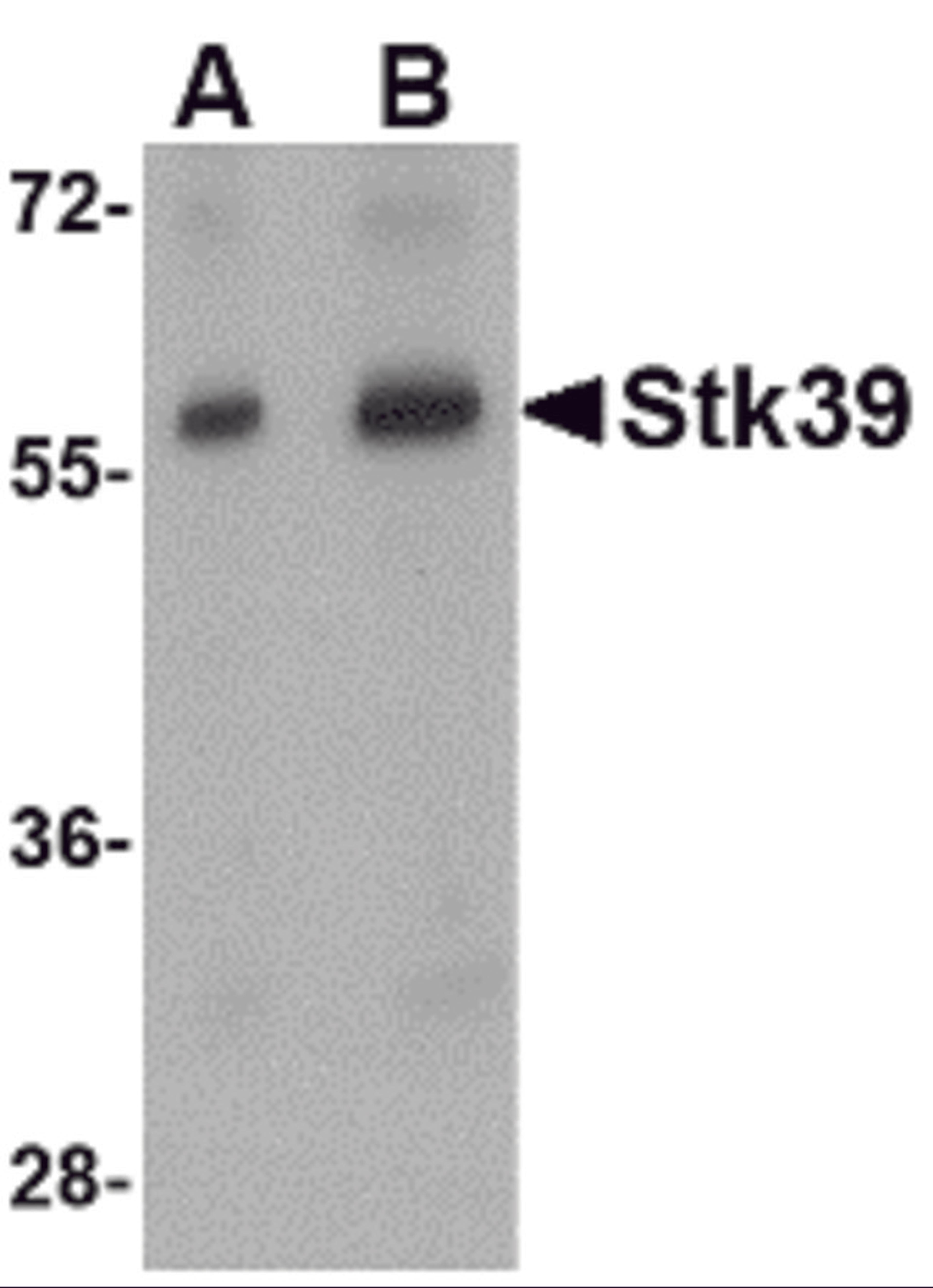 Western blot analysis of Stk39 in rat brain tissue lysate with Stk39 antibody at (A) 1 and (B) 2 μg/mL.