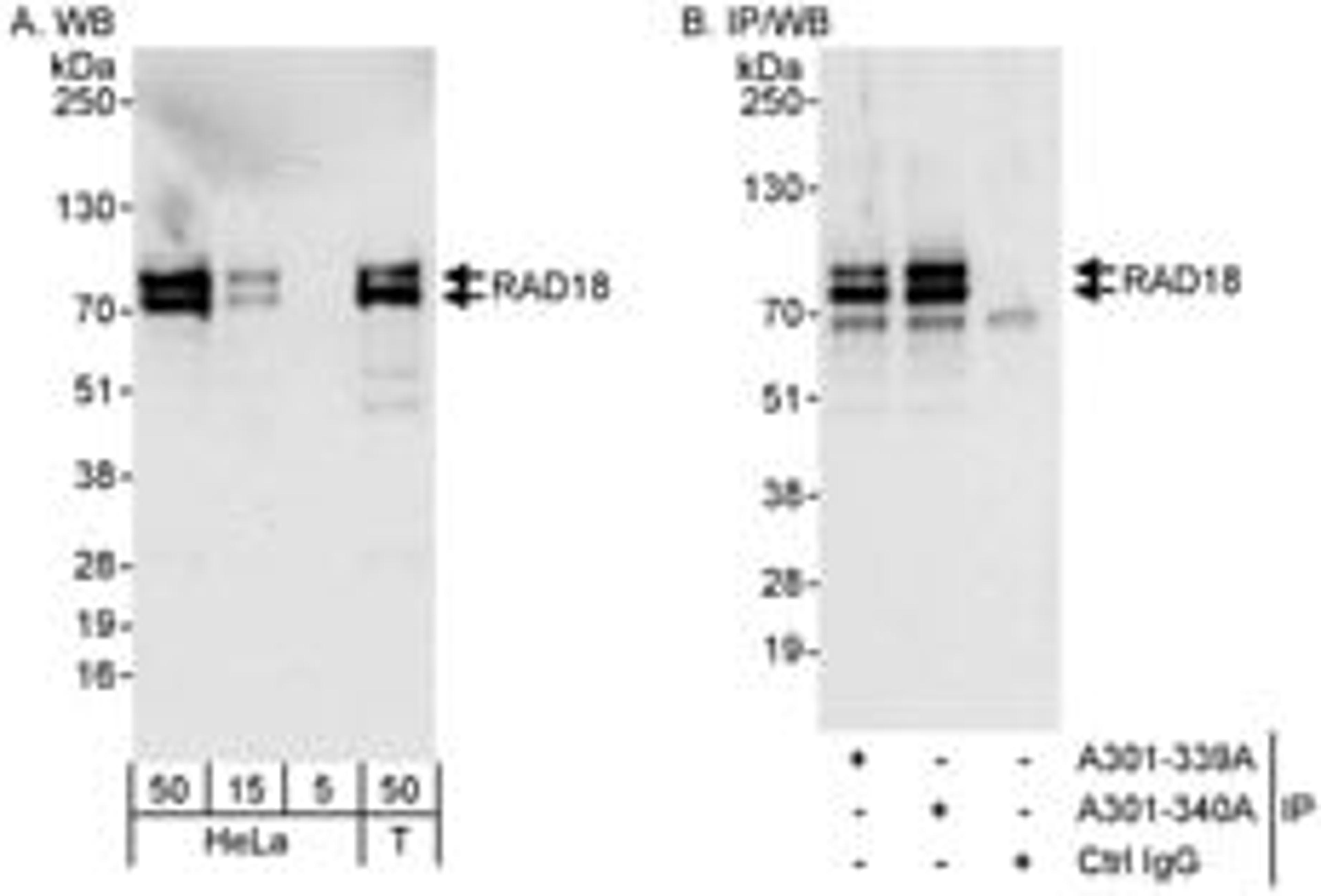 Detection of human RAD18 by western blot and immunoprecipitation.