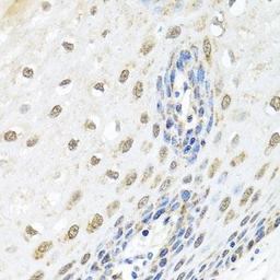 Immunohistochemical staining of human esophagus tissue using ELAC2 antibody (dilution of 1:100)