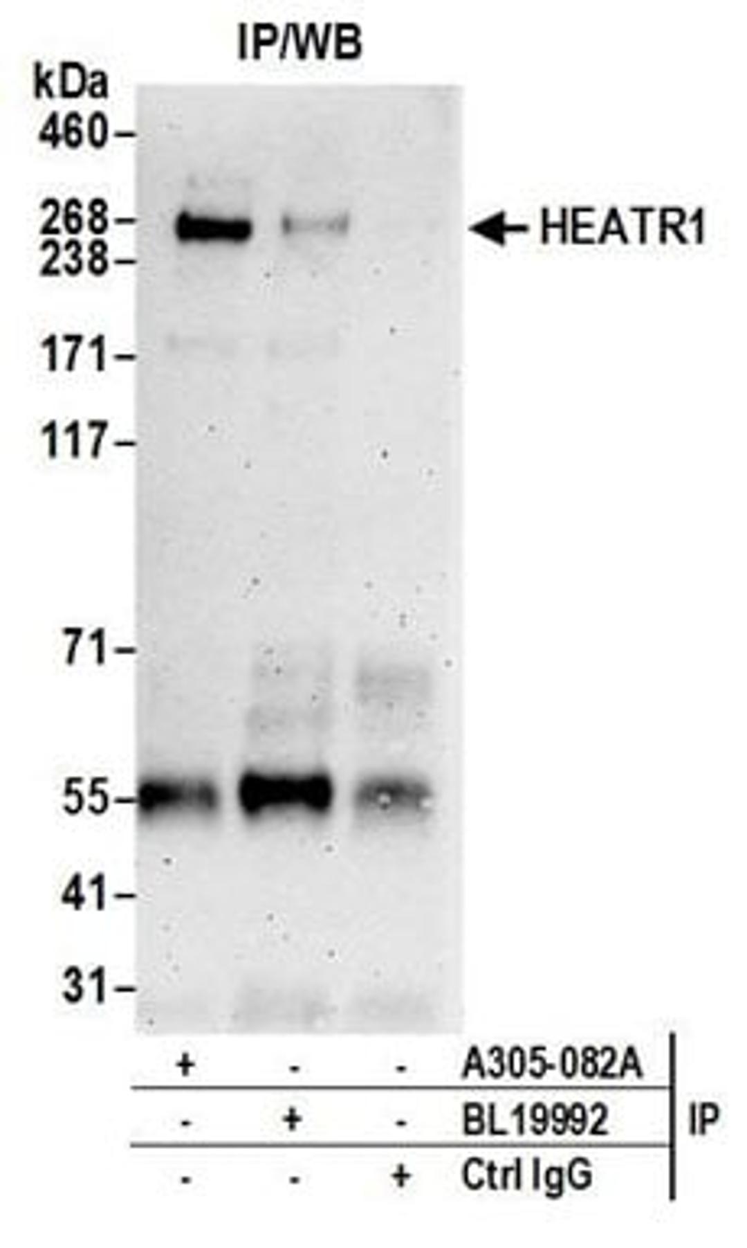 Detection of human HEATR1 by western blot of immunoprecipitates.