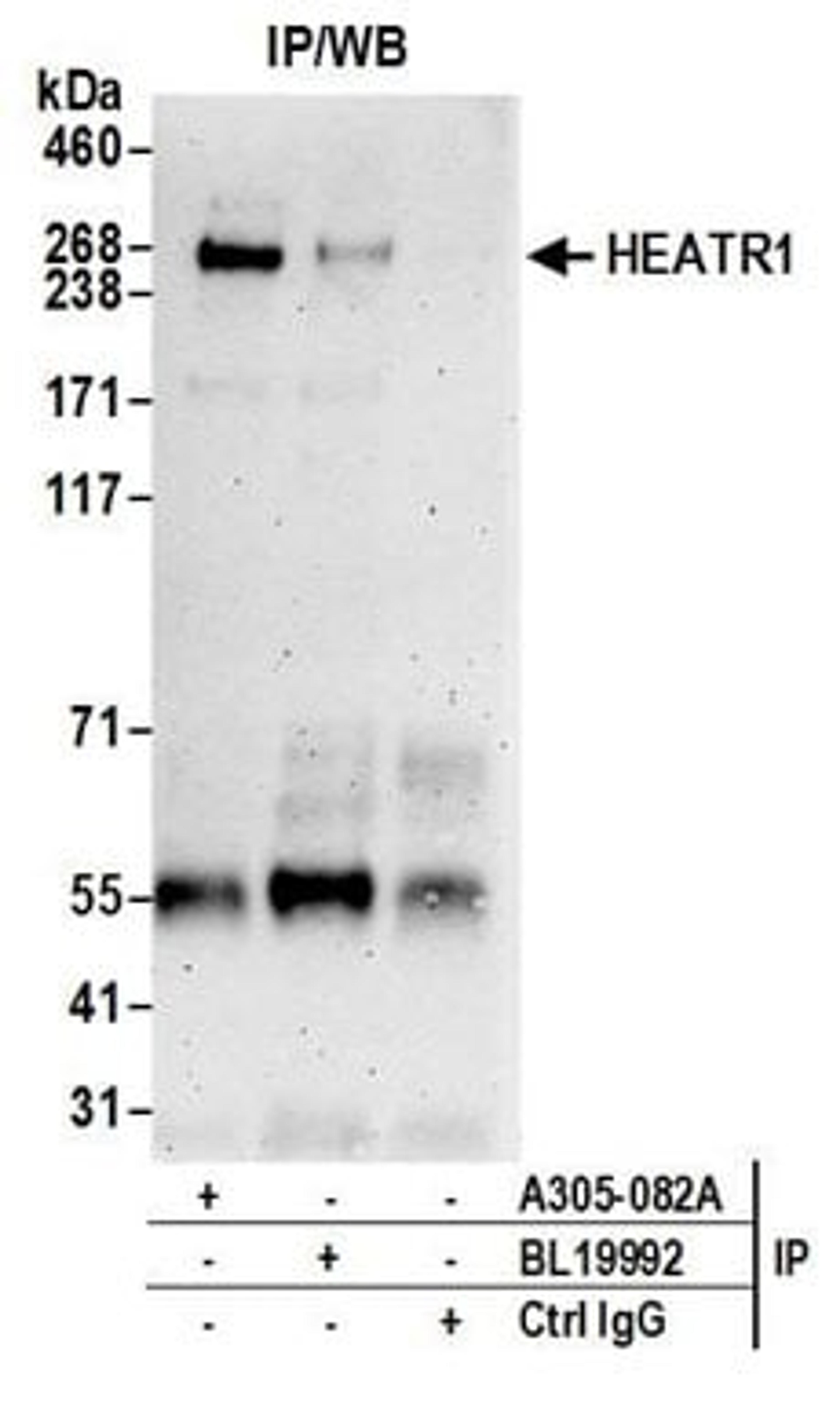 Detection of human HEATR1 by western blot of immunoprecipitates.