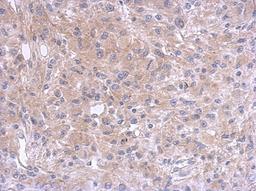 Immunohistochemistry-Paraffin: Amphiregulin Antibody [NBP2-15379] - Paraffin-embedded U37C xenograft, using antibody at 1:500 dilution.