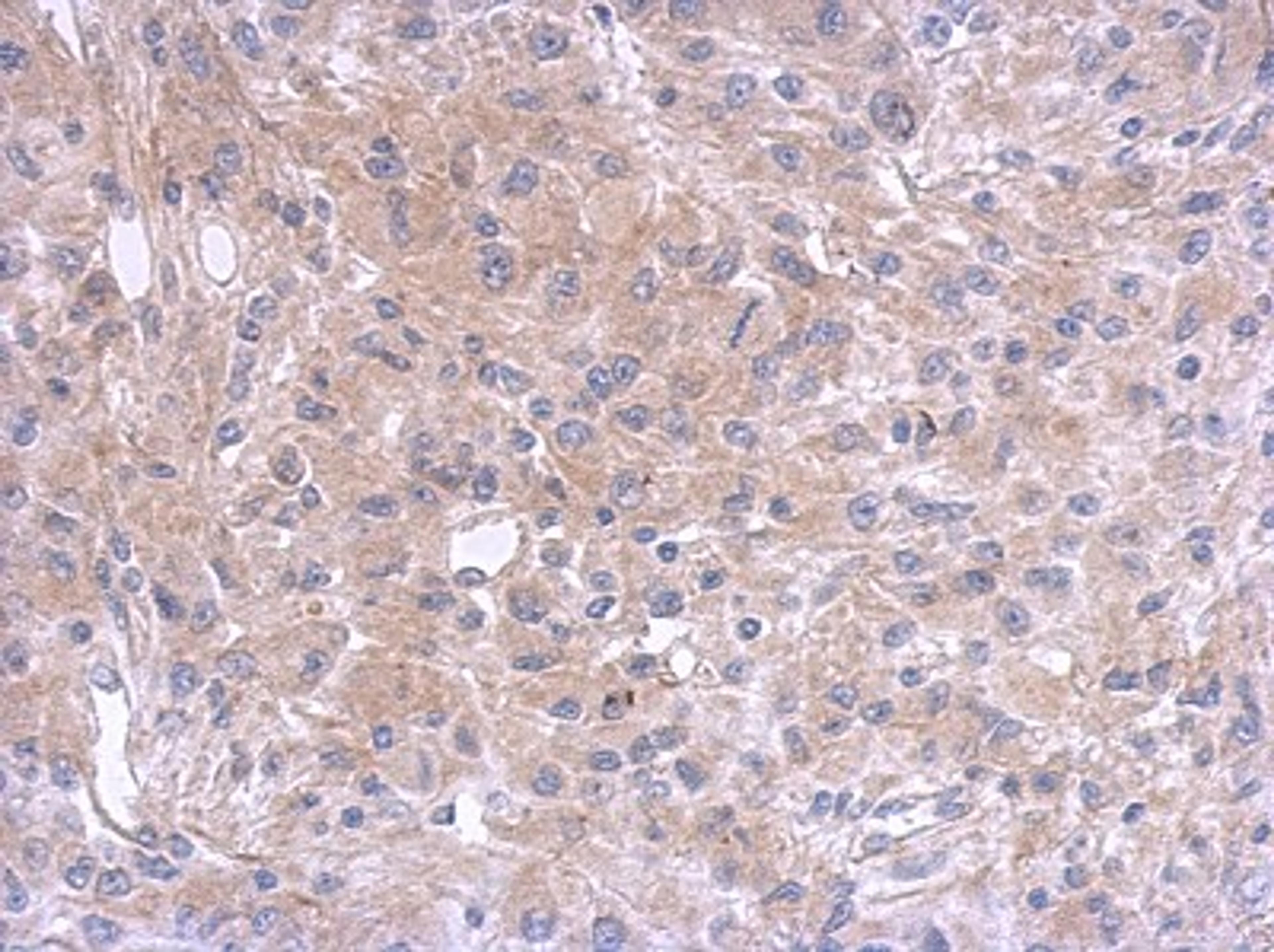 Immunohistochemistry-Paraffin: Amphiregulin Antibody [NBP2-15379] - Paraffin-embedded U37C xenograft, using antibody at 1:500 dilution.