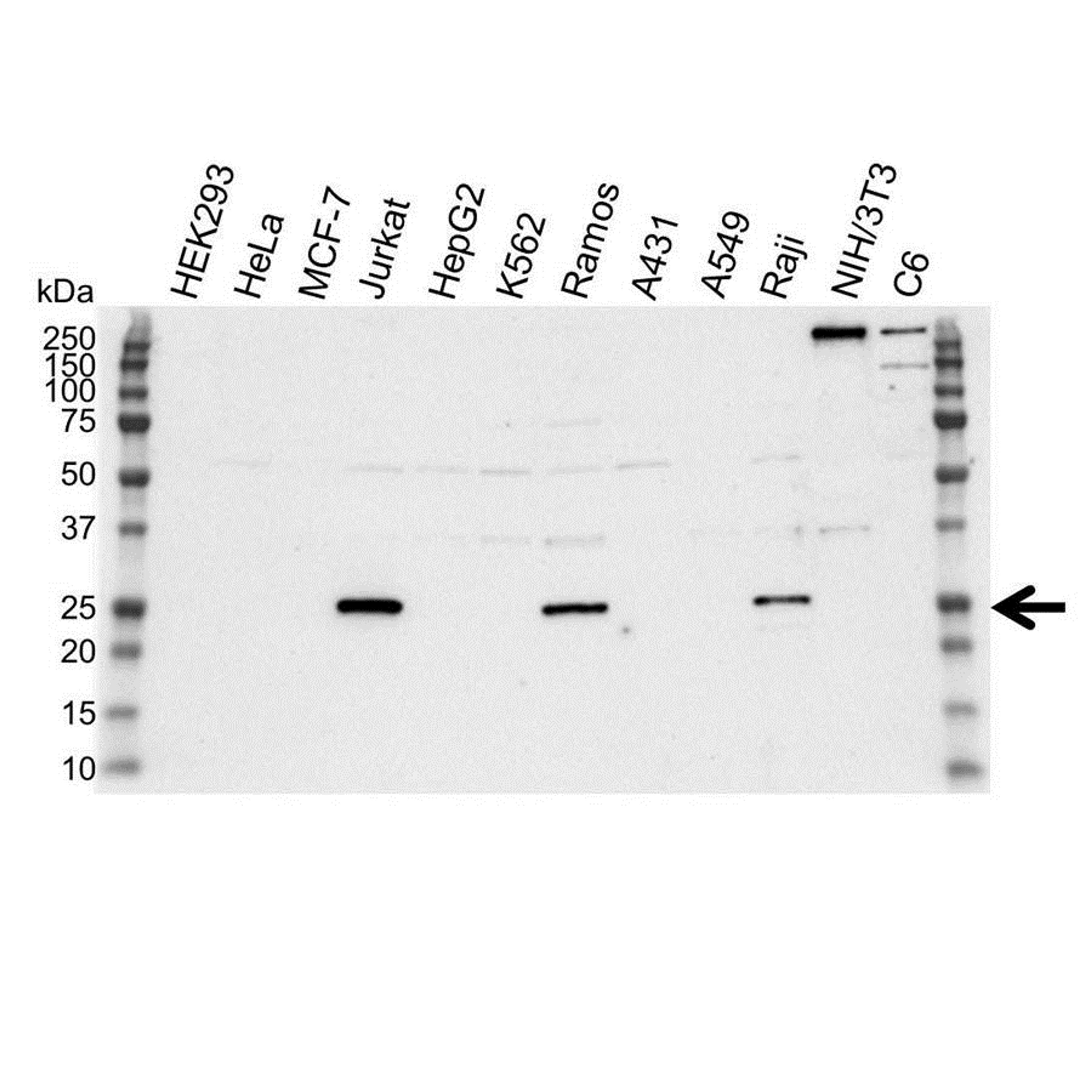 Western blot analysis of whole cell lysates probed with FLIP gamma/delta antibody 