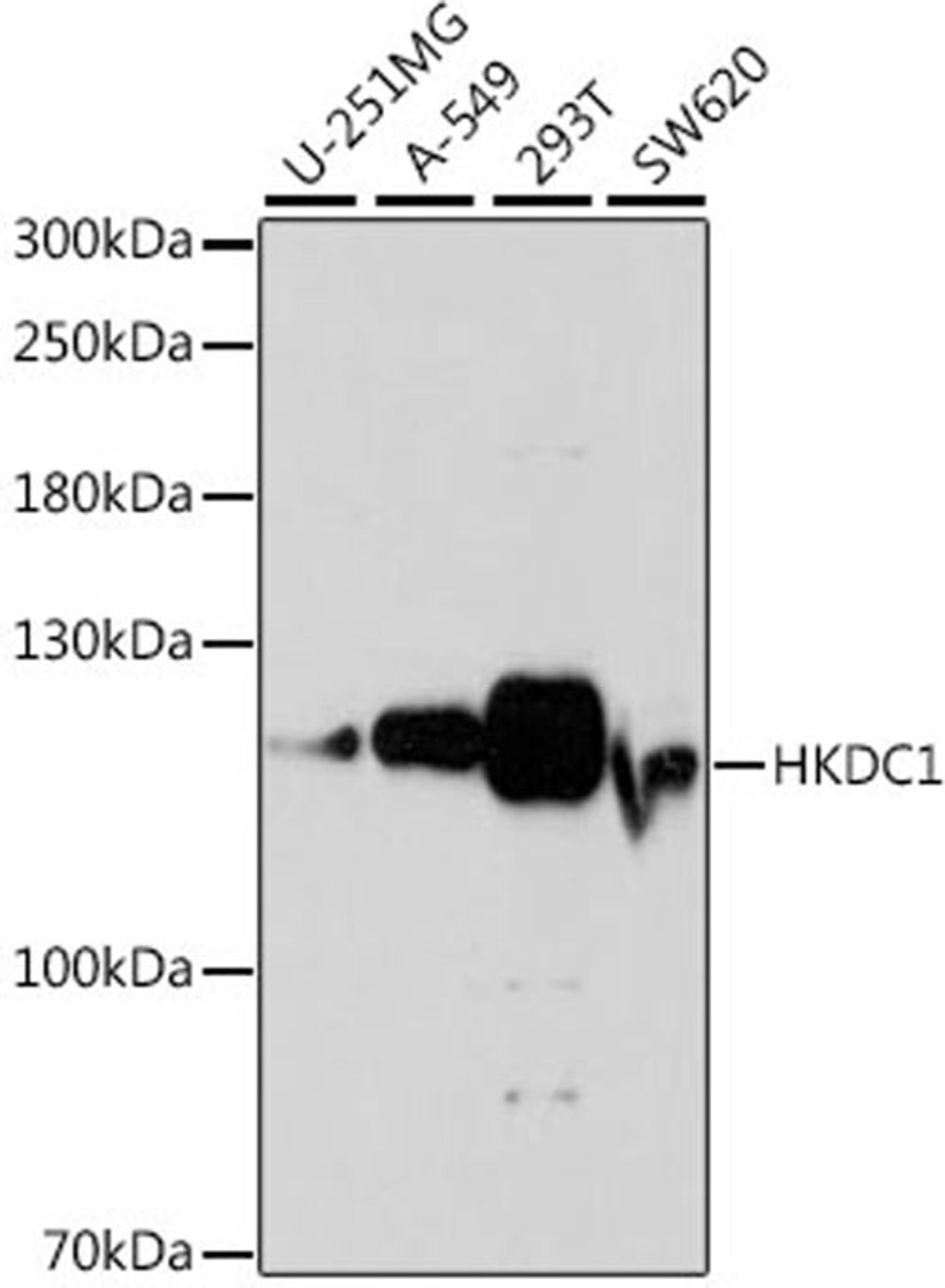 Western blot - HKDC1 antibody (A16573)