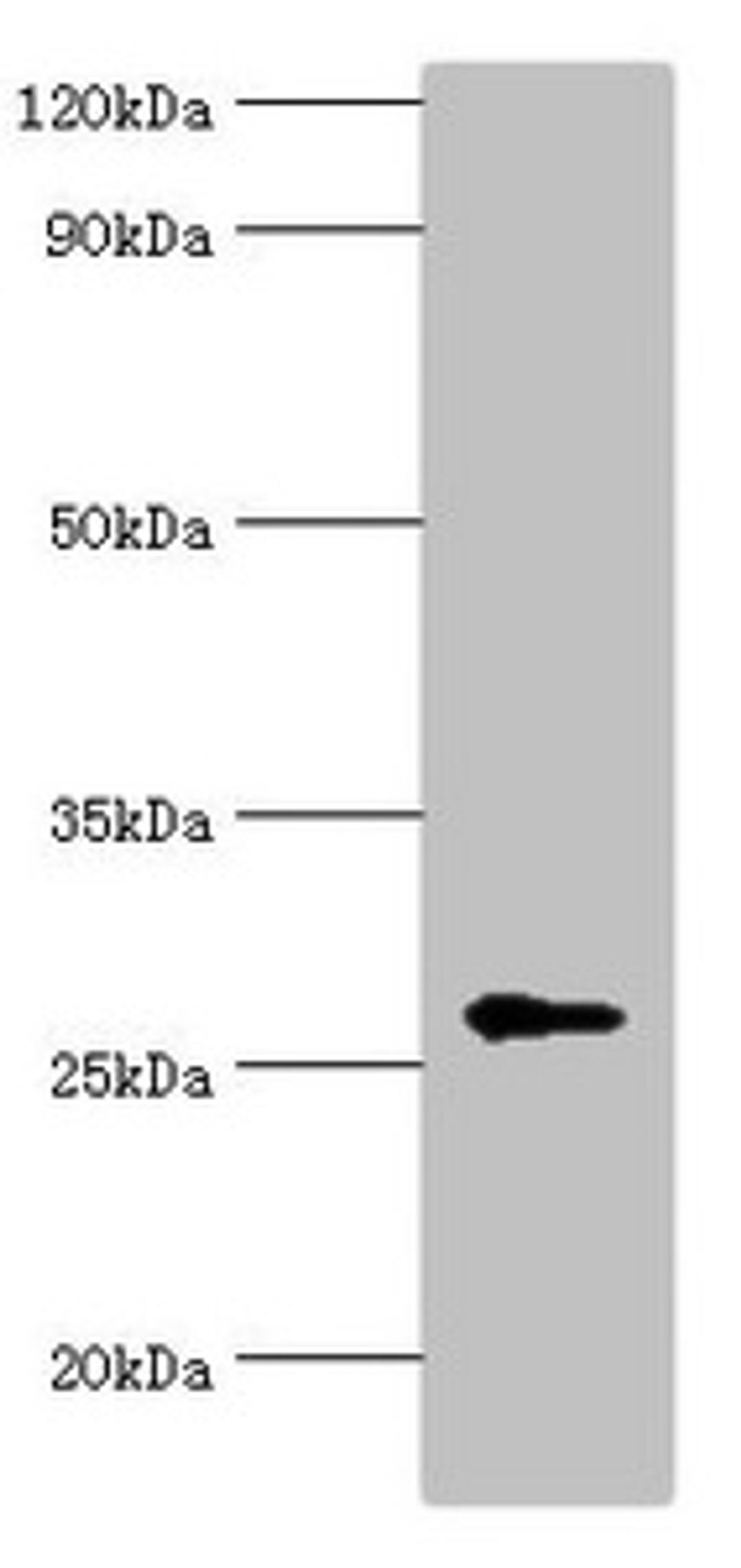 Western blot. All lanes: N-alpha-acetyltransferase 10 antibody at 5ug/ml + Hela whole cell lysate. Secondary. Goat polyclonal to rabbit IgG at 1/10000 dilution. Predicted band size: 27, 25 kDa. Observed band size: 27 kDa. 