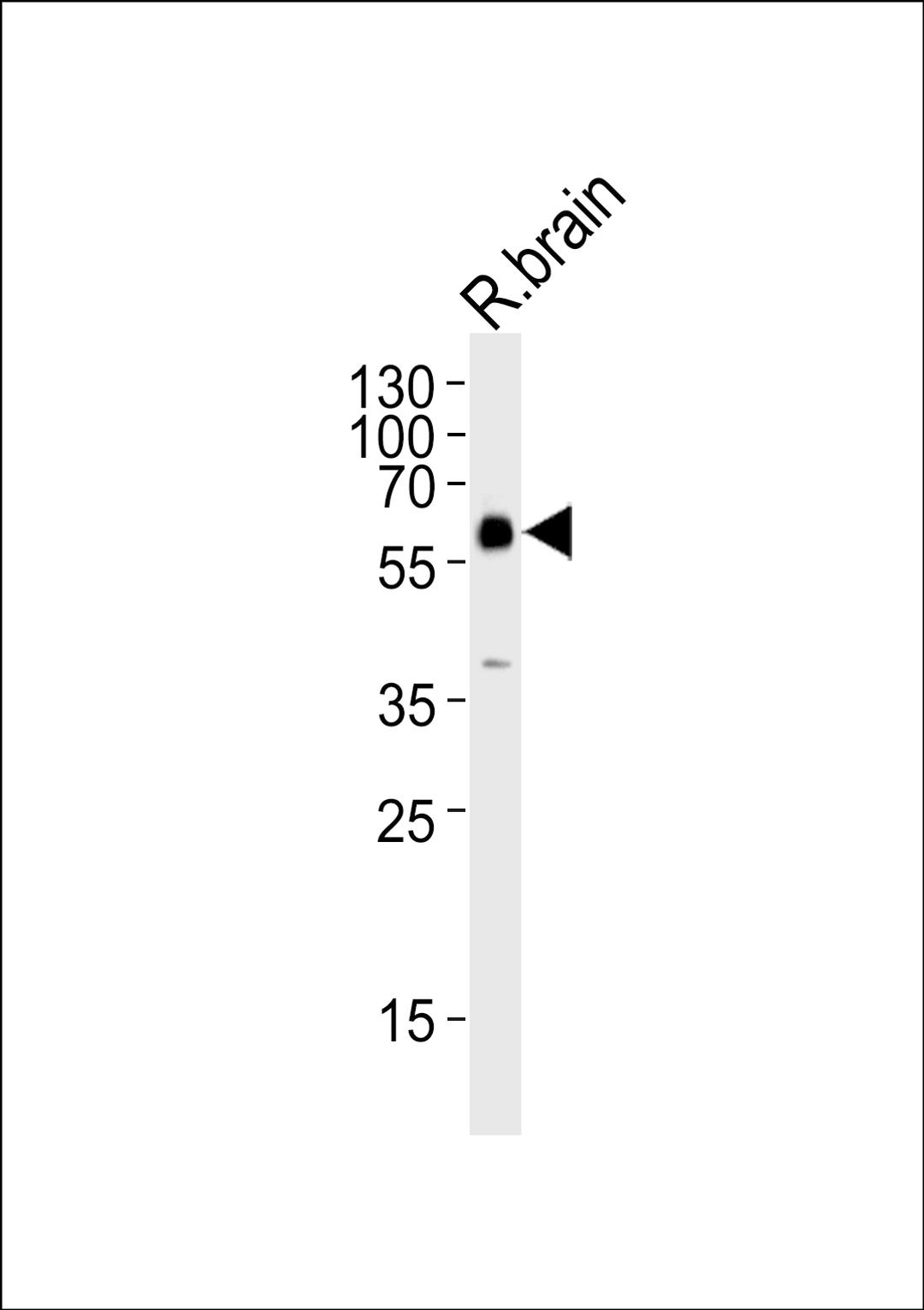 Western blot analysis of lysate from rat brain tissue lysate, using GAD2 Antibody at 1:1000.