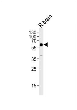 Western blot analysis of lysate from rat brain tissue lysate, using GAD2 Antibody at 1:1000.