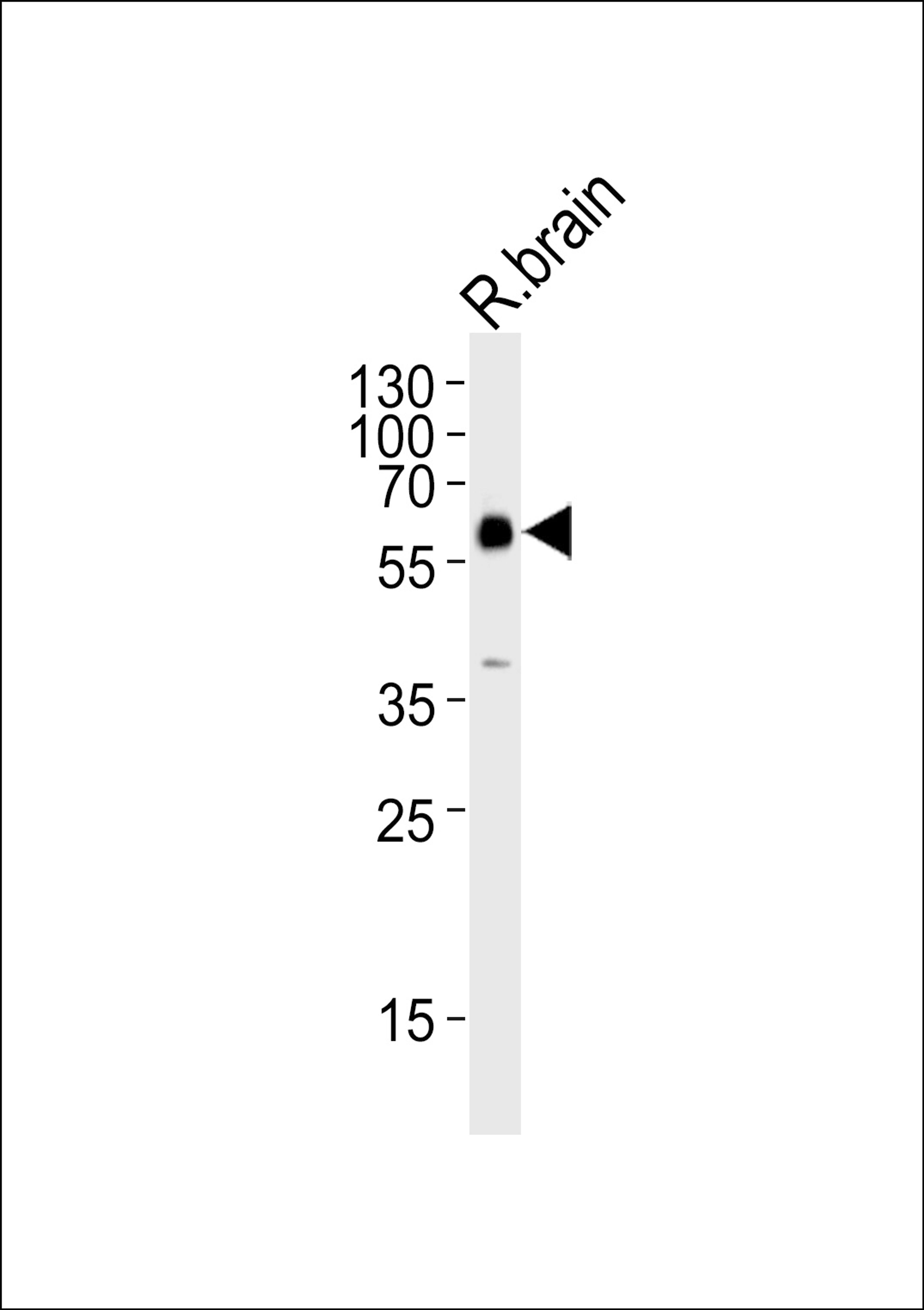 Western blot analysis of lysate from rat brain tissue lysate, using GAD2 Antibody at 1:1000.