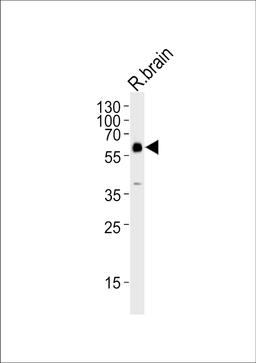 Western blot analysis of lysate from rat brain tissue lysate, using GAD2 Antibody at 1:1000.