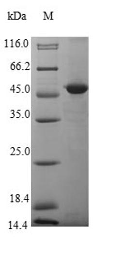 (Tris-Glycine gel) Discontinuous SDS-PAGE (reduced) with 5% enrichment gel and 15% separation gel.