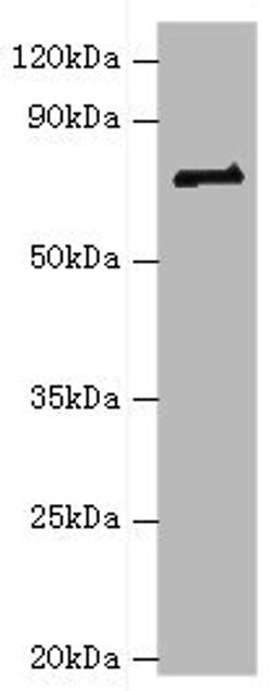 Western blot. All lanes: HNRNPM antibody at 2ug/ml + NIH/3T3 whole cell lysate. Secondary. Goat polyclonal to rabbit IgG at 1/10000 dilution. Predicted band size: 78, 74 kDa. Observed band size: 78 kDa. 