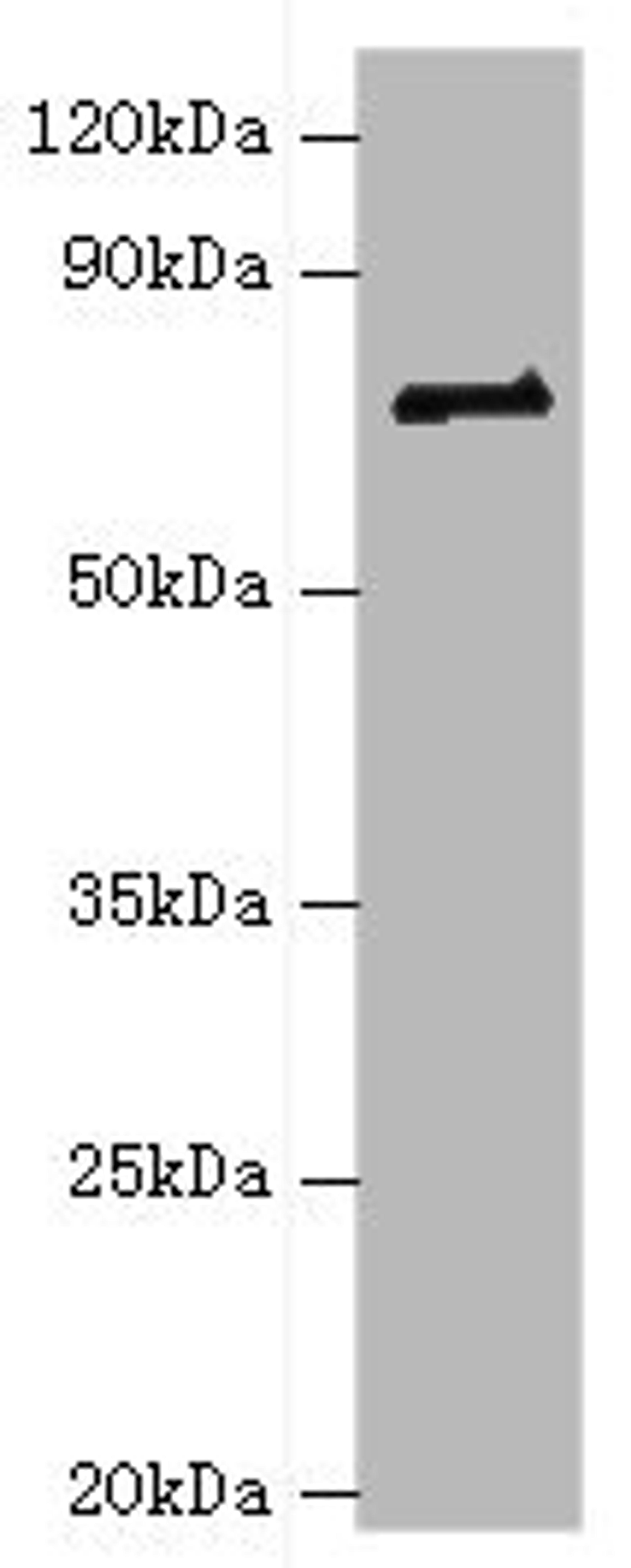 Western blot. All lanes: HNRNPM antibody at 2ug/ml + NIH/3T3 whole cell lysate. Secondary. Goat polyclonal to rabbit IgG at 1/10000 dilution. Predicted band size: 78, 74 kDa. Observed band size: 78 kDa. 