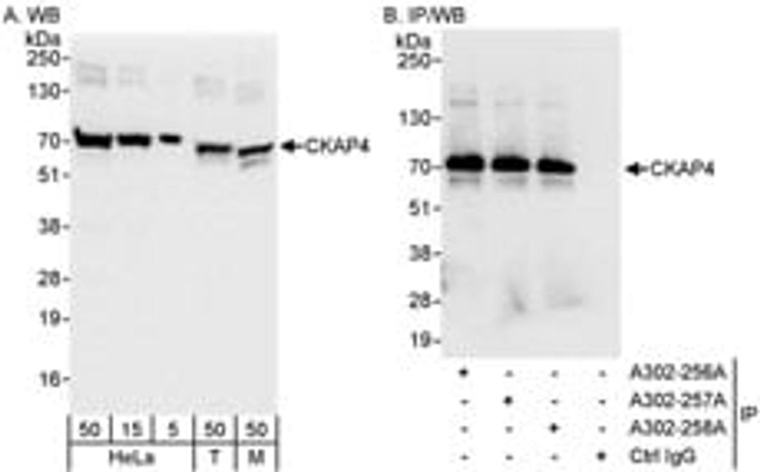 Detection of human and mouse CKAP4 by western blot (h&m) and immunoprecipitation (h).