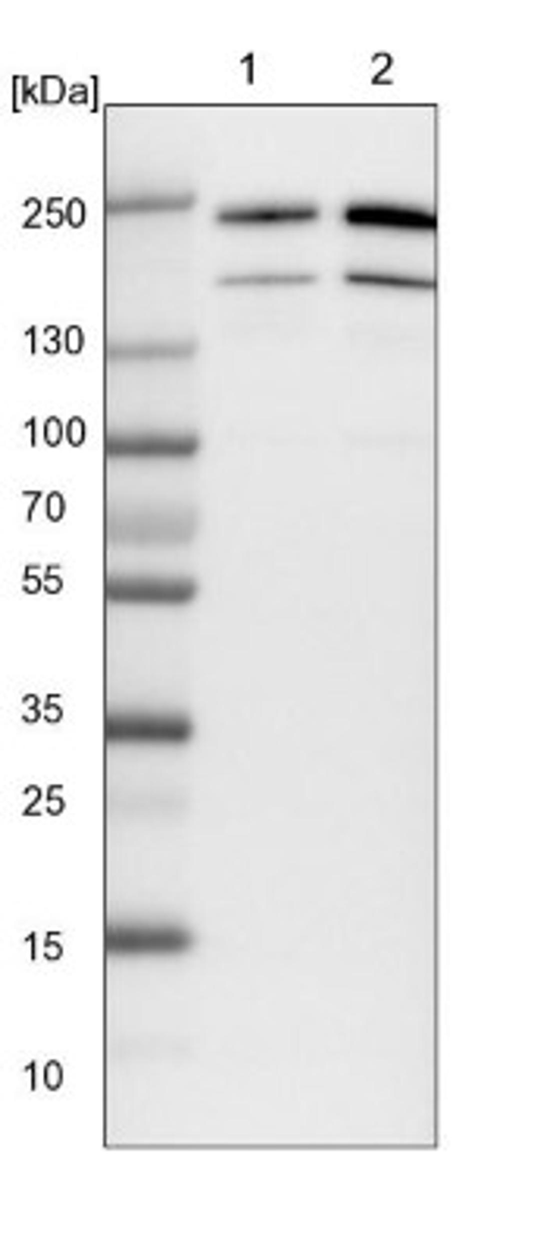 Western Blot: RAP6 Antibody [NBP1-85137] - Lane 1: NIH-3T3 cell lysate (Mouse embryonic fibroblast cells)<br/>Lane 2: NBT-II cell lysate (Rat Wistar bladder tumour cells)