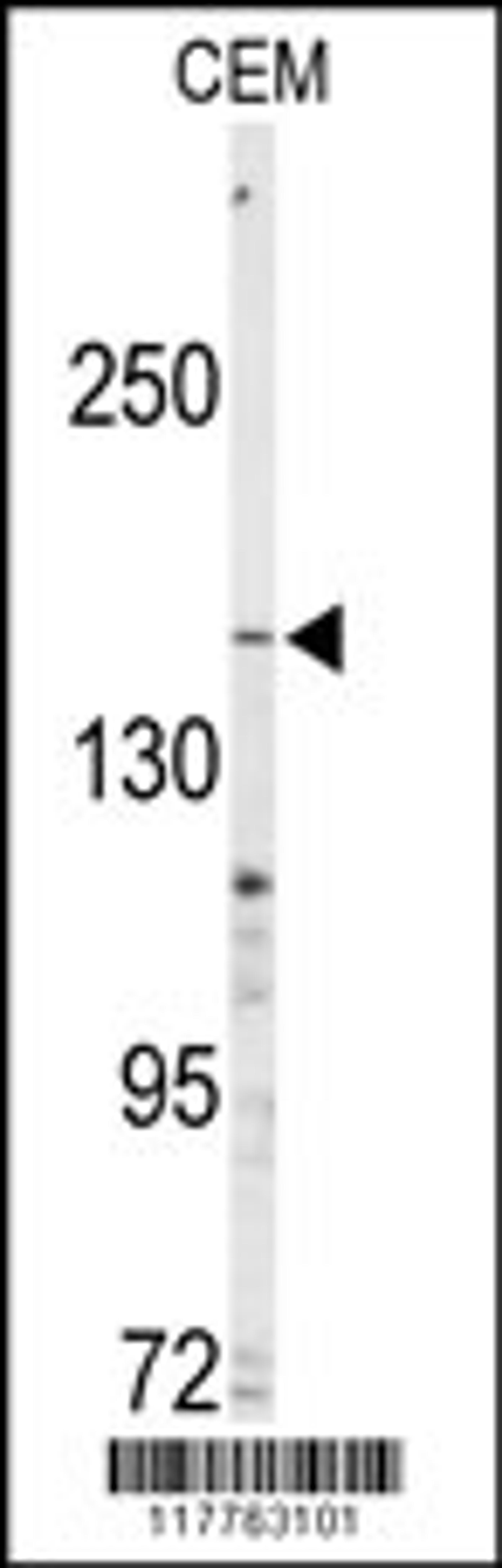 Western blot analysis of anti-ABCC4 Antibody in CEM cell line lysates (35ug/lane)