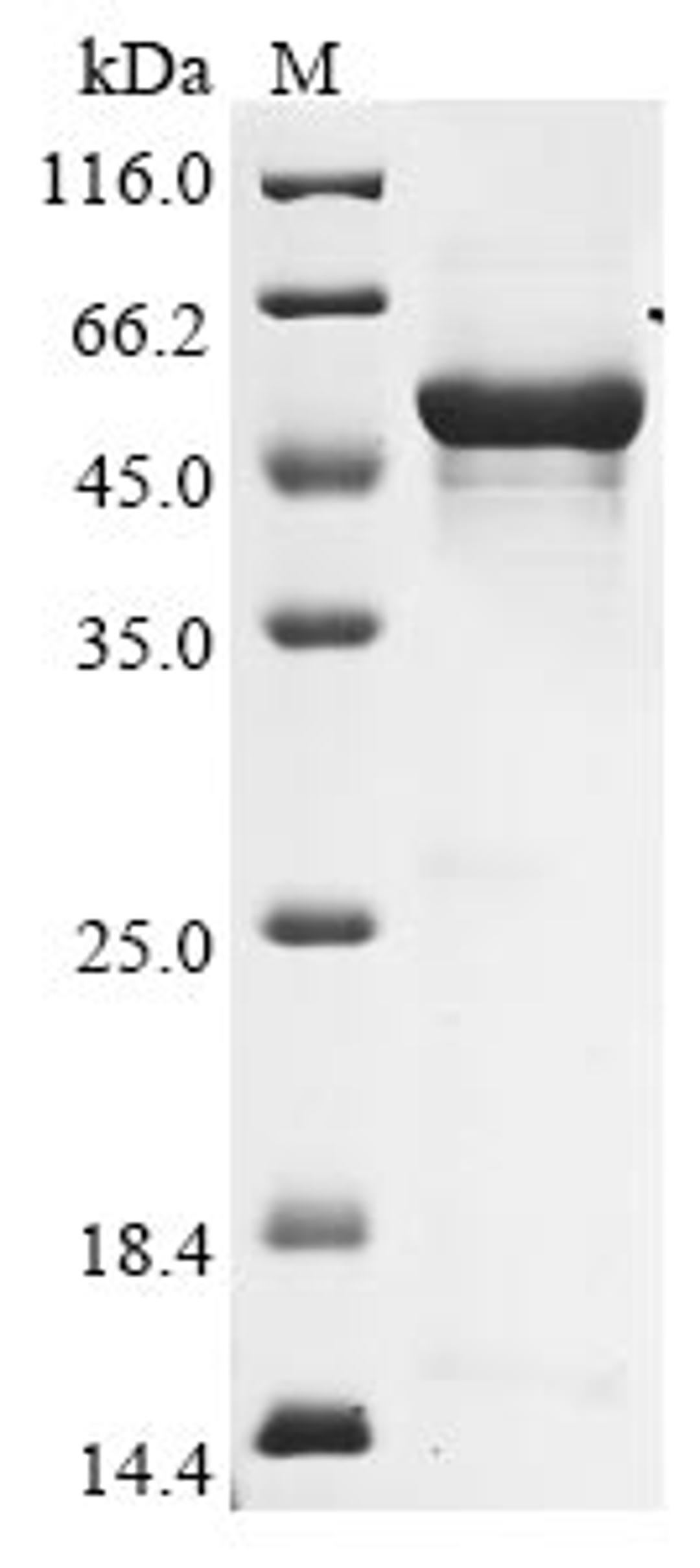 (Tris-Glycine gel) Discontinuous SDS-PAGE (reduced) with 5% enrichment gel and 15% separation gel.