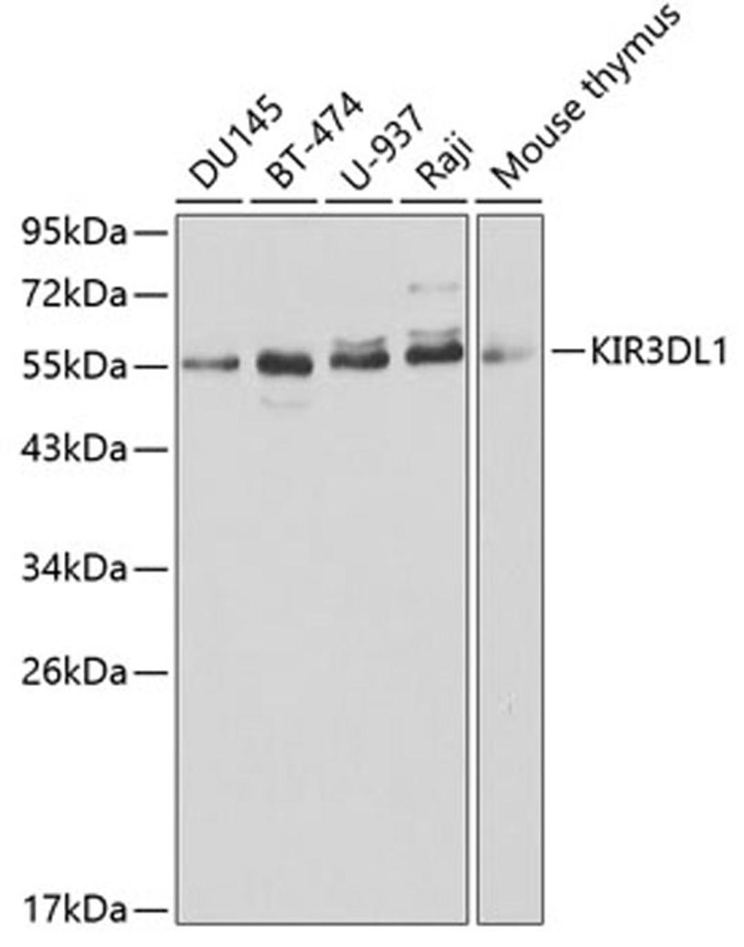 Western blot - KIR3DL1 antibody (A1617)