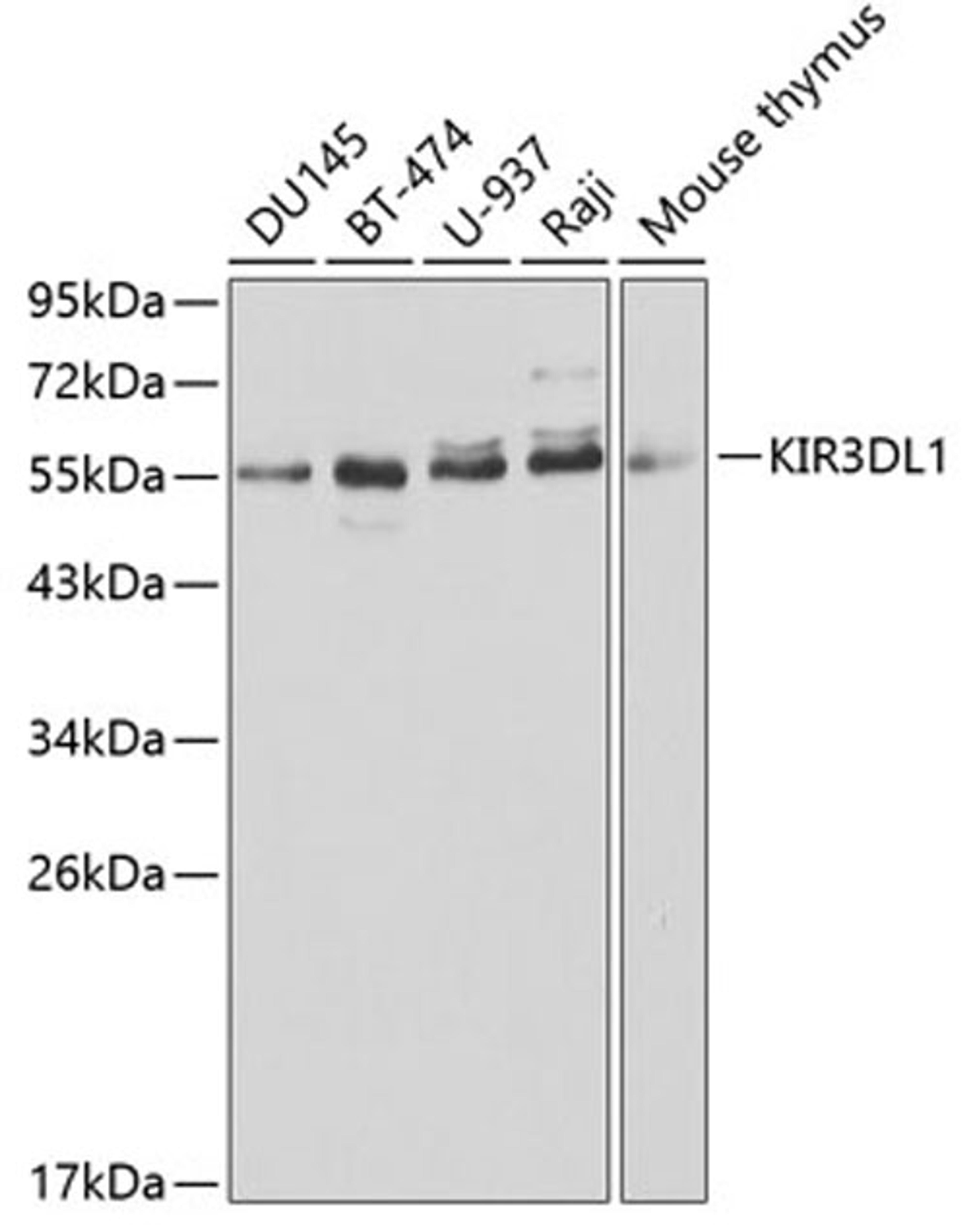 Western blot - KIR3DL1 antibody (A1617)