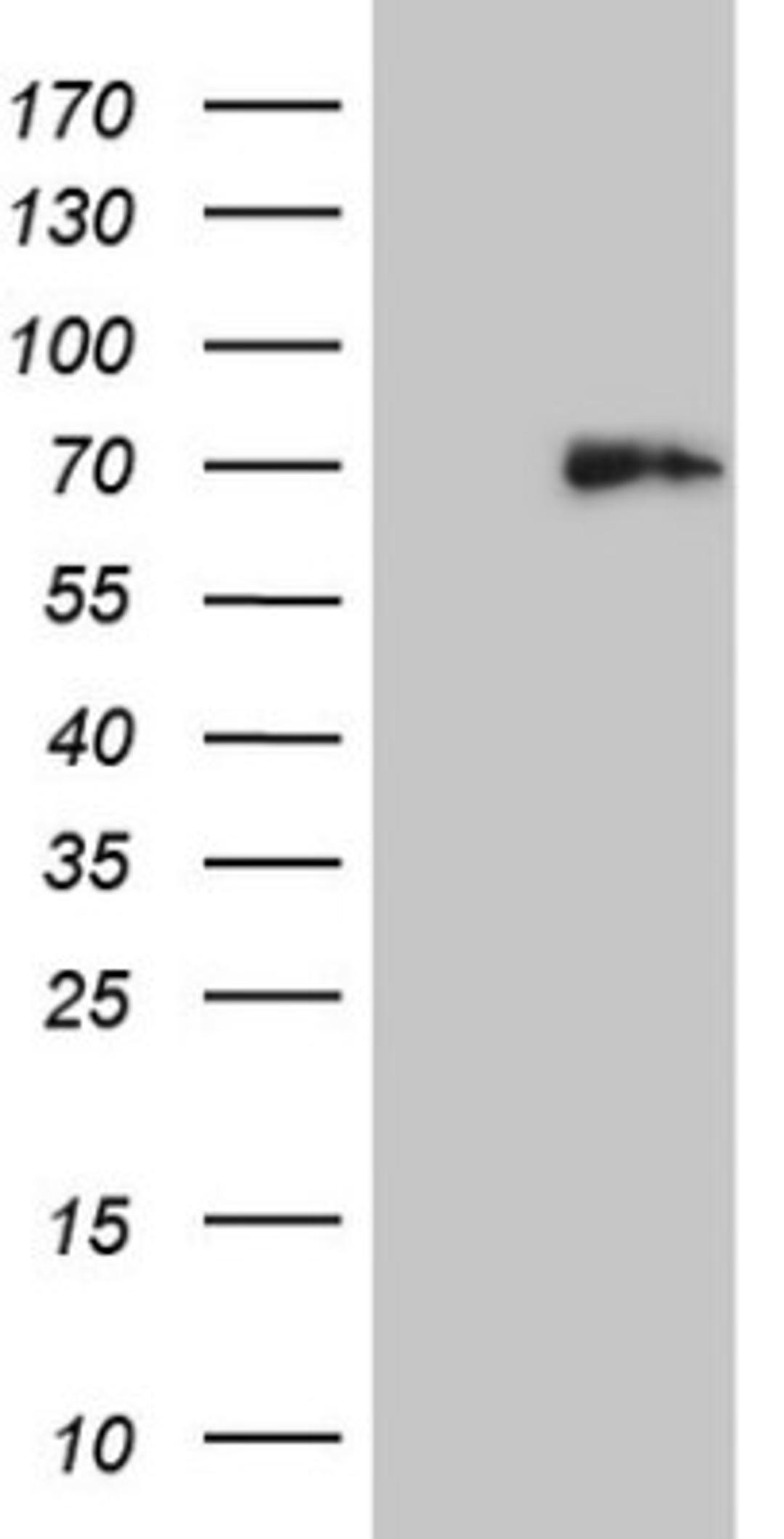 Western Blot: Histone Deacetylase 2/HDAC2 Antibody (7E10) [NBP2-45949] - Analysis of HEK293T cells were transfected with the pCMV6-ENTRY control (Left lane) or pCMV6-ENTRY HDAC2.