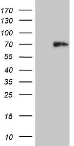 Western Blot: Histone Deacetylase 2/HDAC2 Antibody (7E10) [NBP2-45949] - Analysis of HEK293T cells were transfected with the pCMV6-ENTRY control (Left lane) or pCMV6-ENTRY HDAC2.