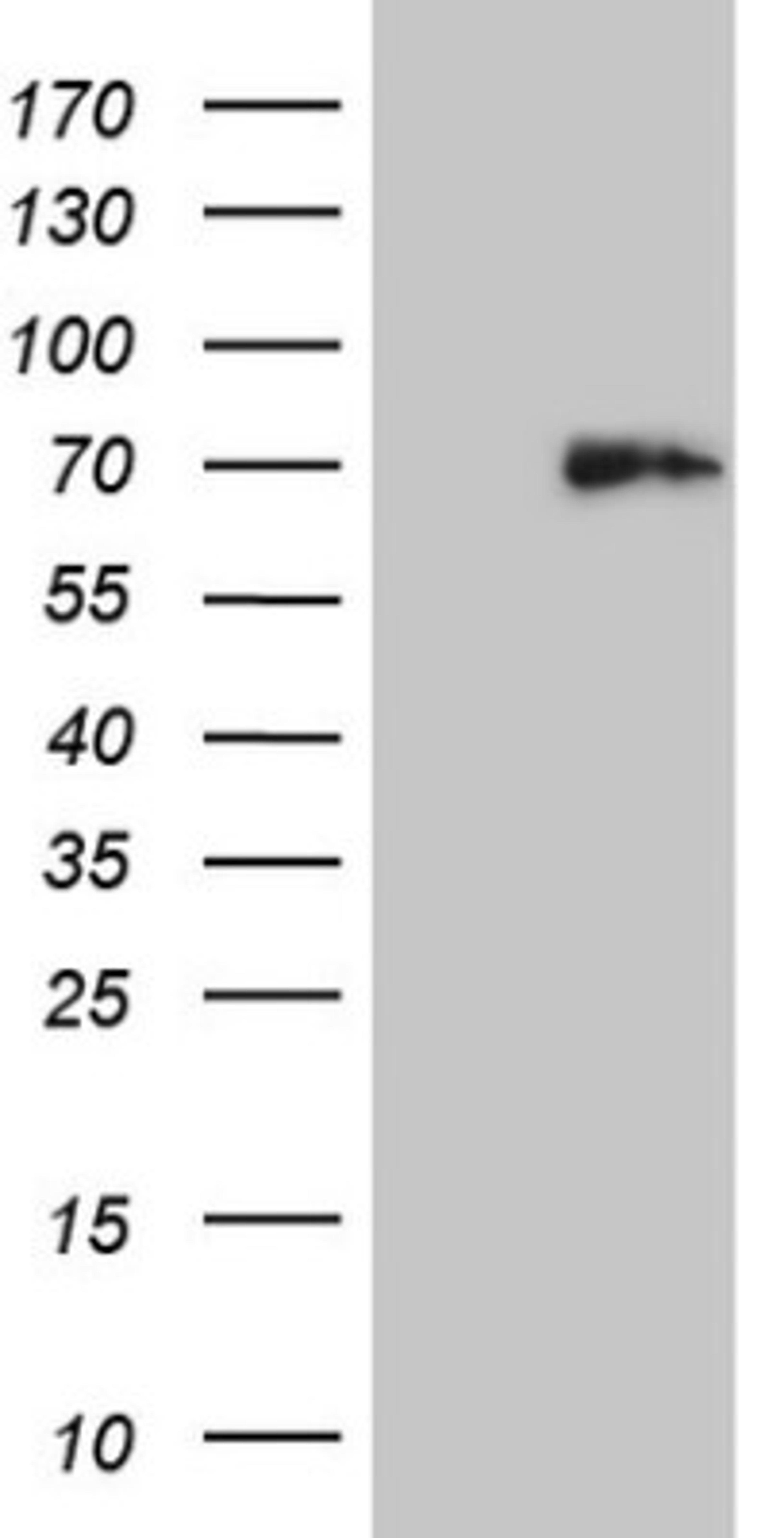 Western Blot: Histone Deacetylase 2/HDAC2 Antibody (7E10) [NBP2-45949] - Analysis of HEK293T cells were transfected with the pCMV6-ENTRY control (Left lane) or pCMV6-ENTRY HDAC2.