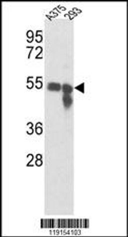 Western blot analysis of Tyrosinase Antibody in A375, 293 cell line lysates (35ug/lane)