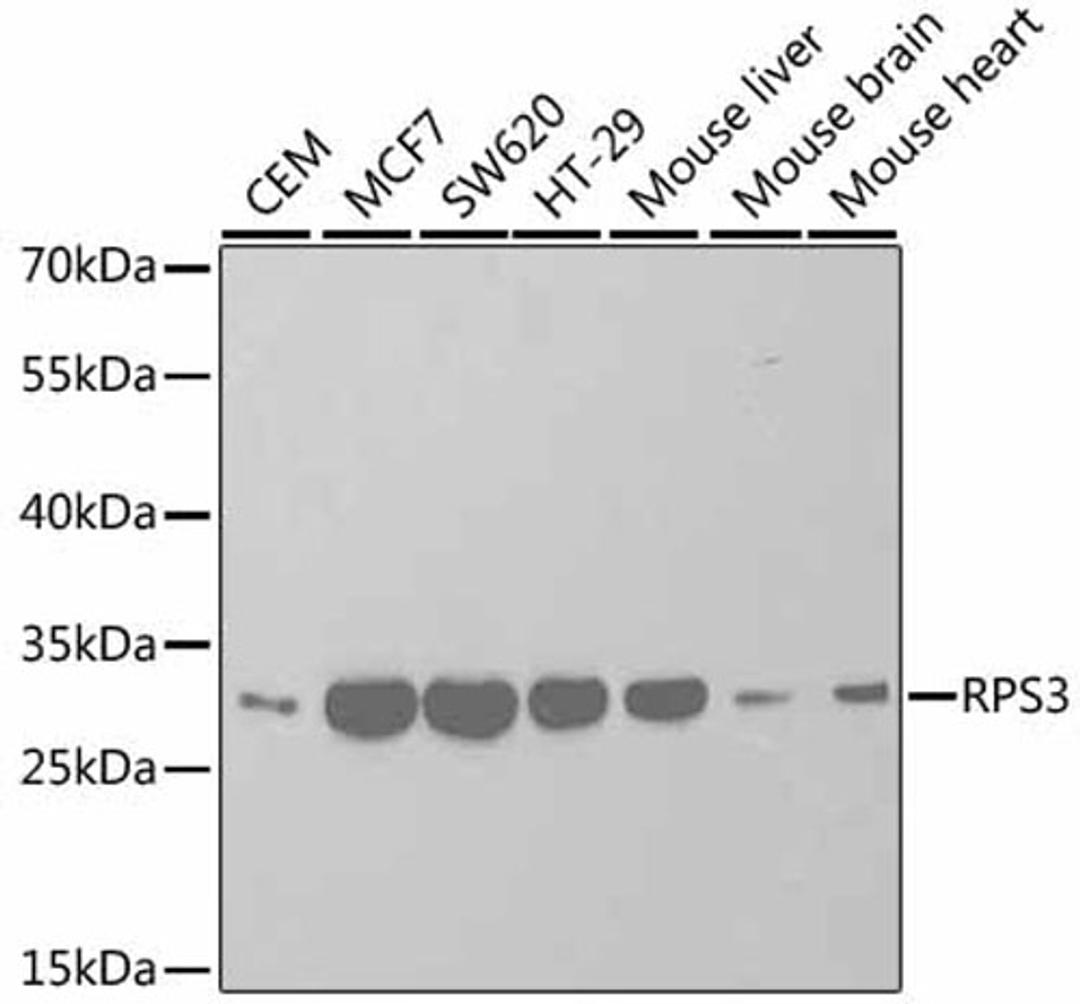 Western blot - RPS3 antibody (A2533)