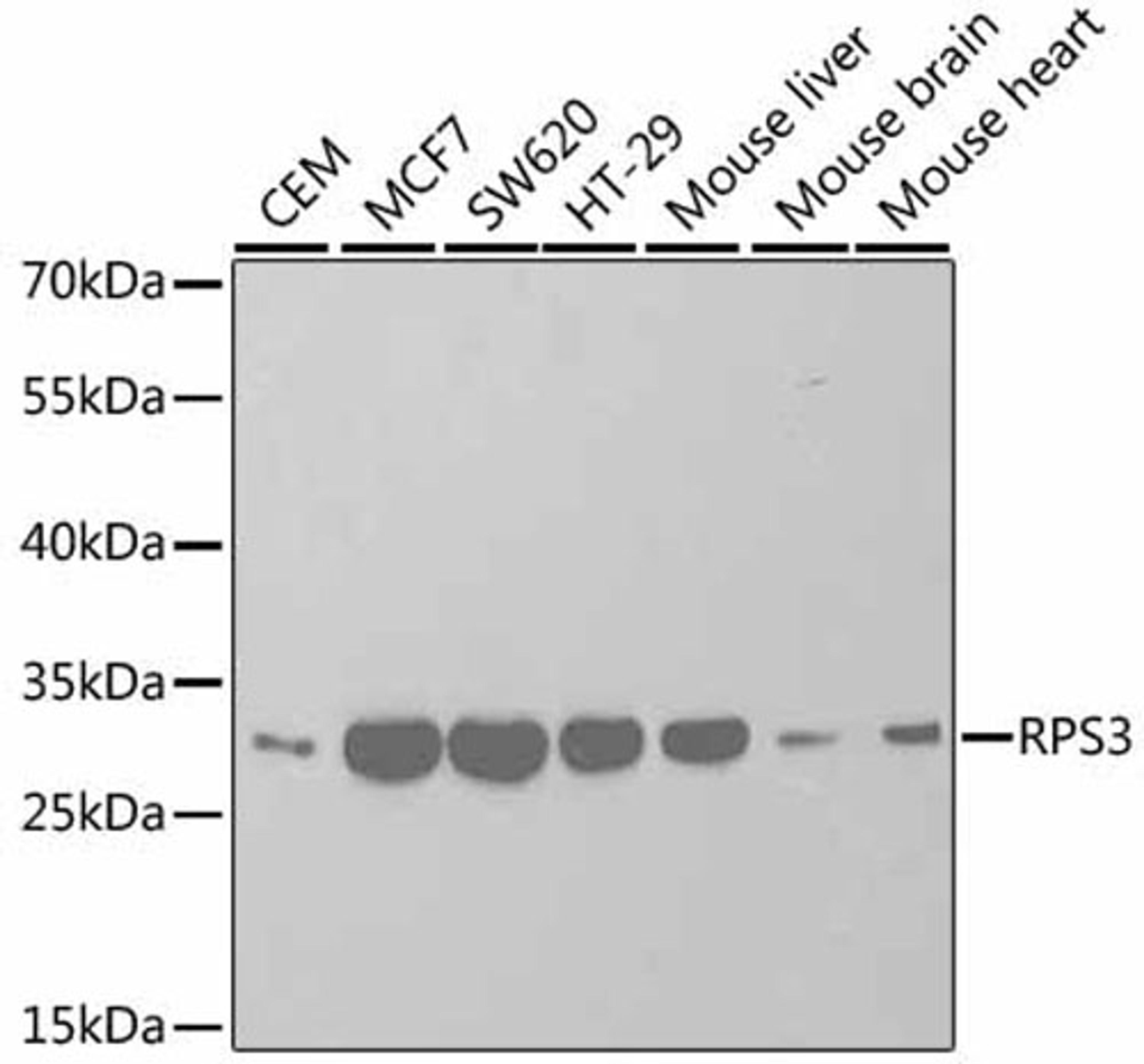 Western blot - RPS3 antibody (A2533)