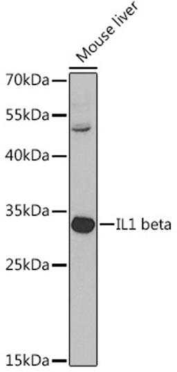 Western blot - IL1 beta antibody (A1112)