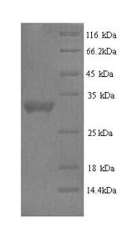 (Tris-Glycine gel) Discontinuous SDS-PAGE (reduced) with 5% enrichment gel and 15% separation gel.