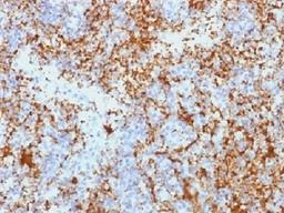 IHC testing of FFPE human spleen tissue with CD61 antibody (clone Y2/51). Required HIER: boil tissue sections in 10mM Tris with 1mM EDTA, pH 9.0, for 10-20 min.