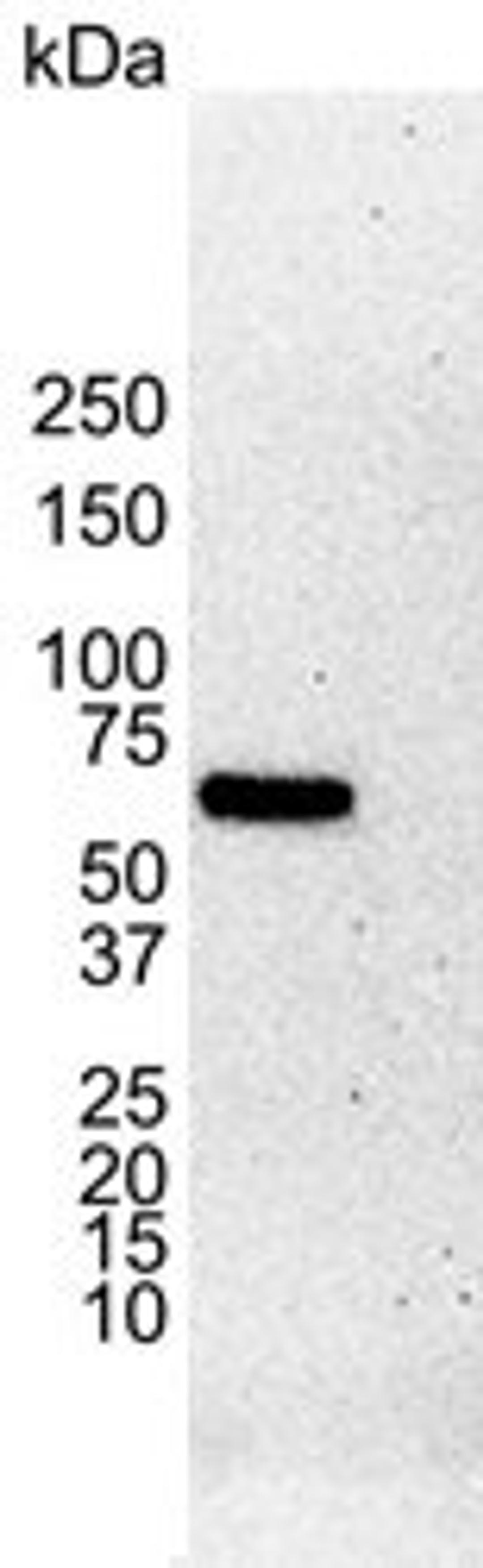 Western blot analysis of MCF-7 human breast adenocarcinoma whole cell lysate