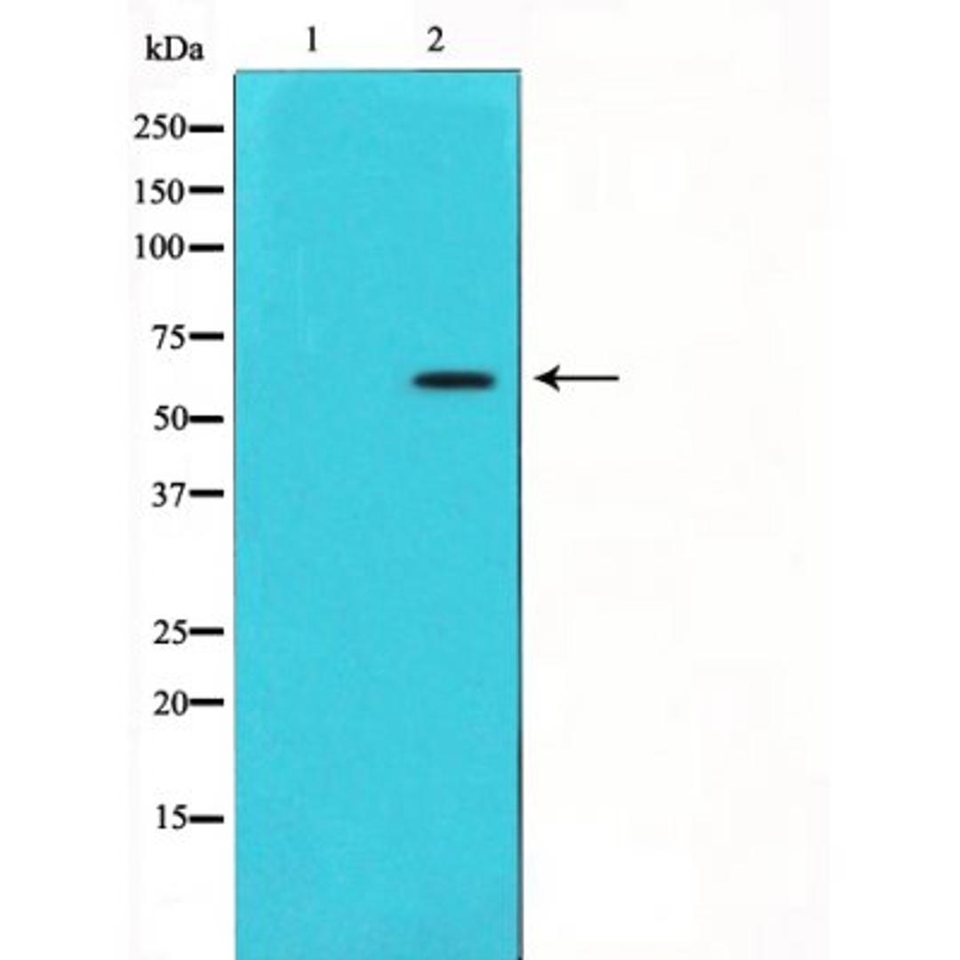 Western blot analysis of P62/SQSTM1 expression in HeLa using P62/SQSTM1 antibody