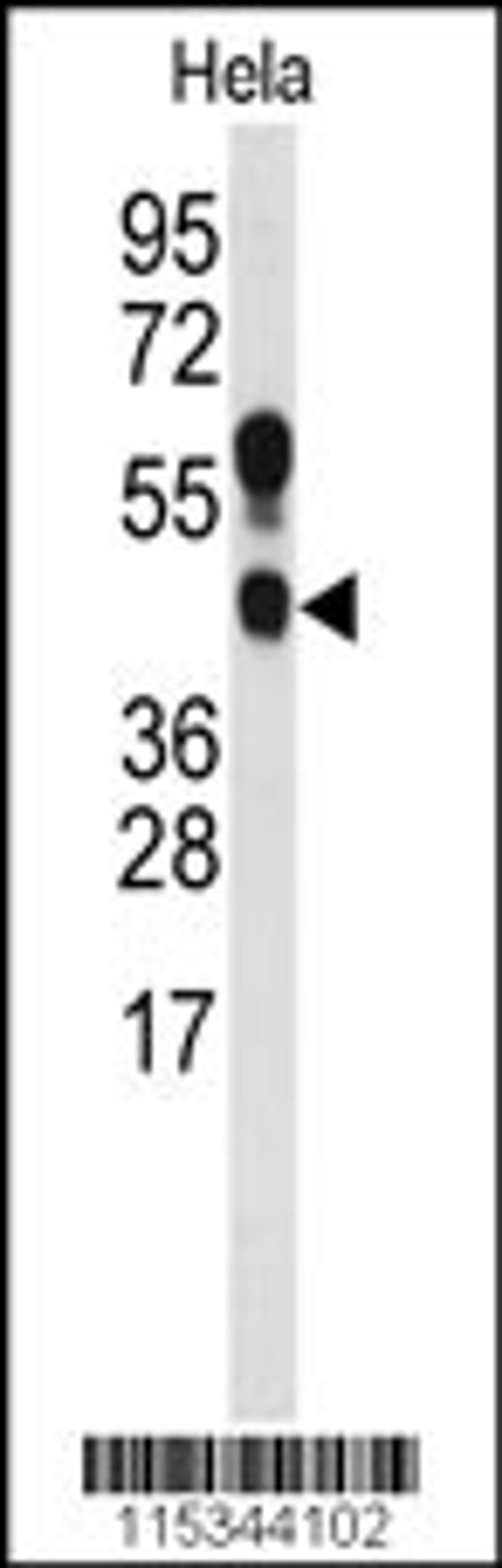 Western blot analysis of anti- in Hela cell line lysates (35ug/lane)