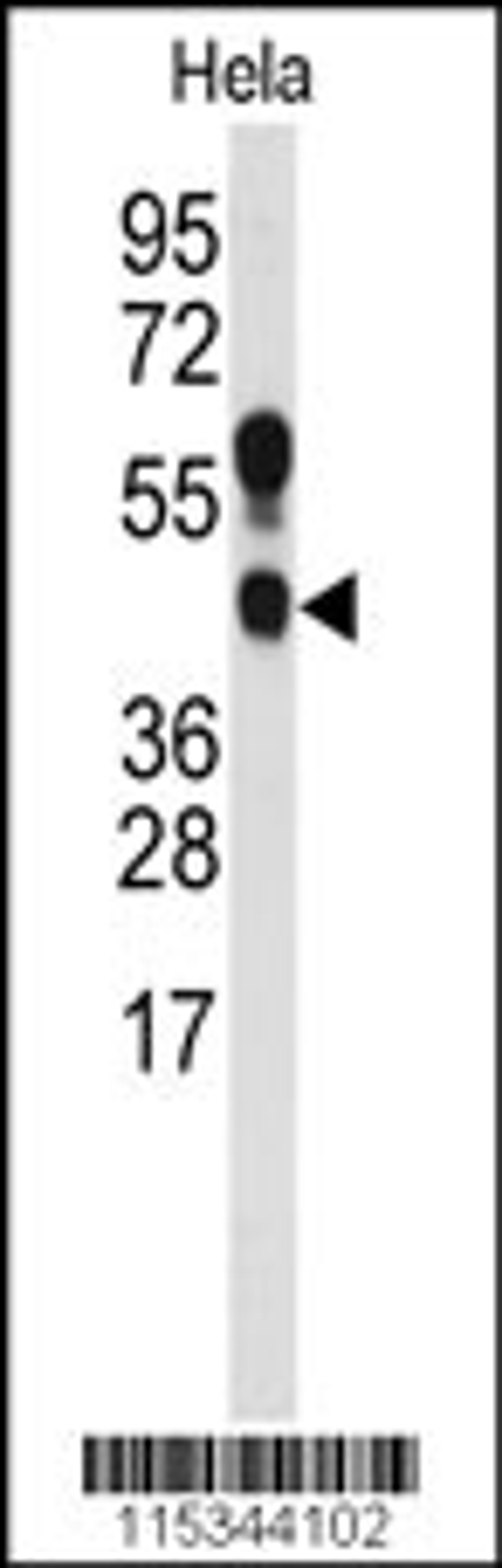 Western blot analysis of anti- in Hela cell line lysates (35ug/lane)