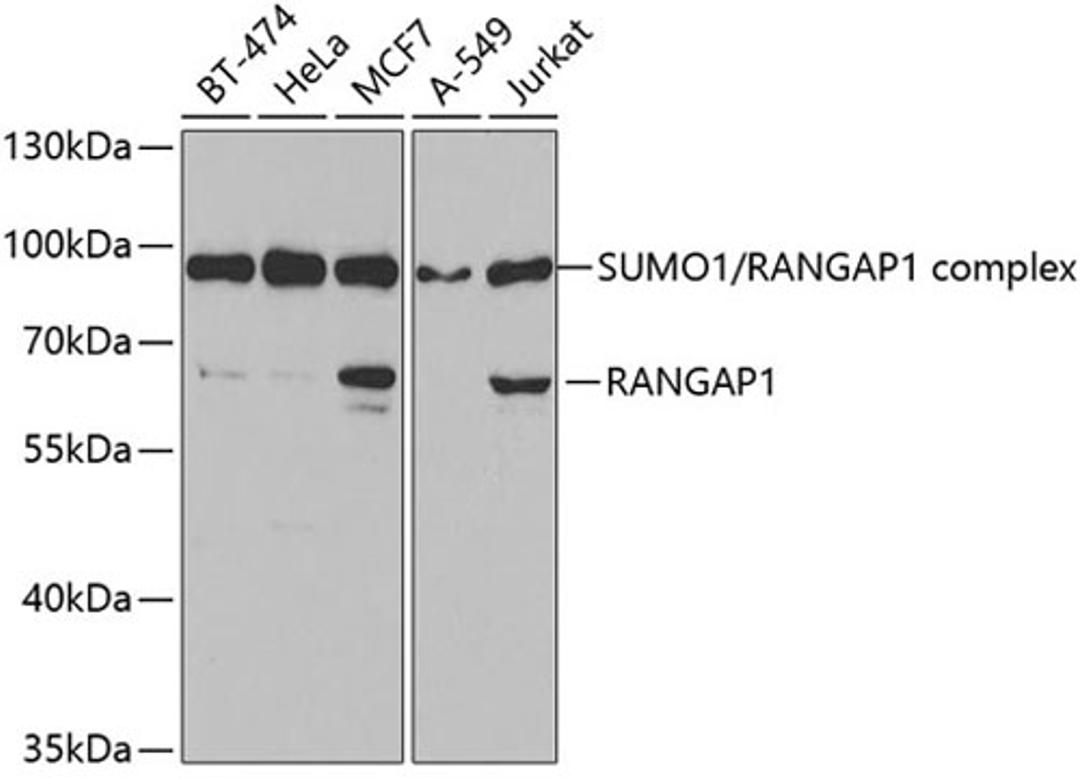 Western blot - RANGAP1 antibody (A5381)