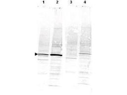 Western blot analysis of CaM Kinase IV using CaM Kinase IV antibody