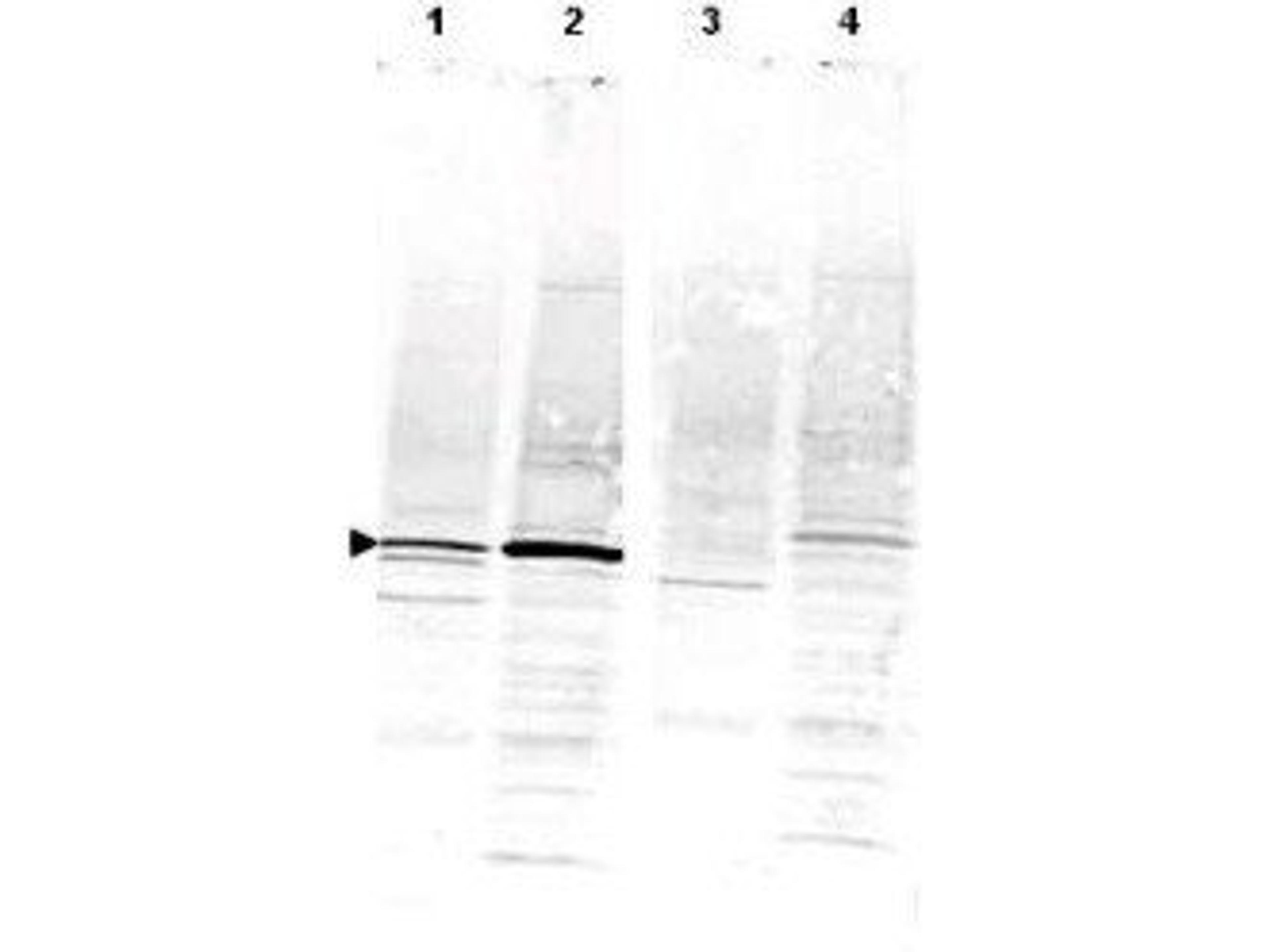 Western blot analysis of CaM Kinase IV using CaM Kinase IV antibody