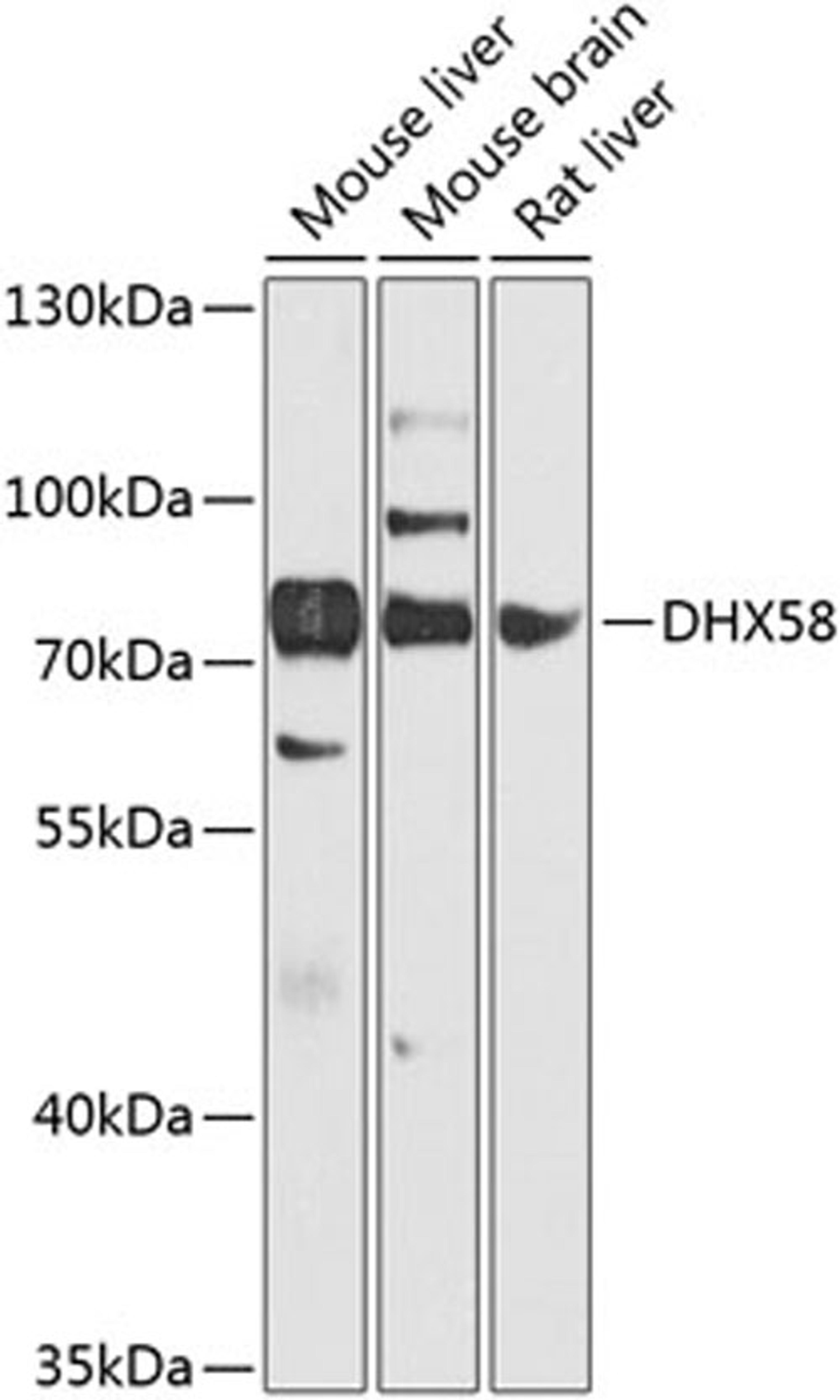 Western blot - DHX58 antibody (A8257)