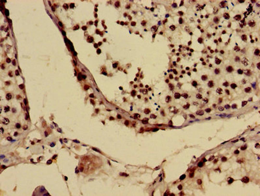 Immunohistochemistry of paraffin-embedded human testis tissue using CSB-PA025694LA01HU at dilution of 1:100