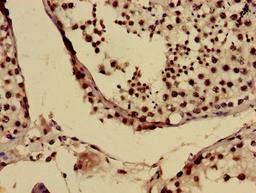 Immunohistochemistry of paraffin-embedded human testis tissue using CSB-PA025694LA01HU at dilution of 1:100