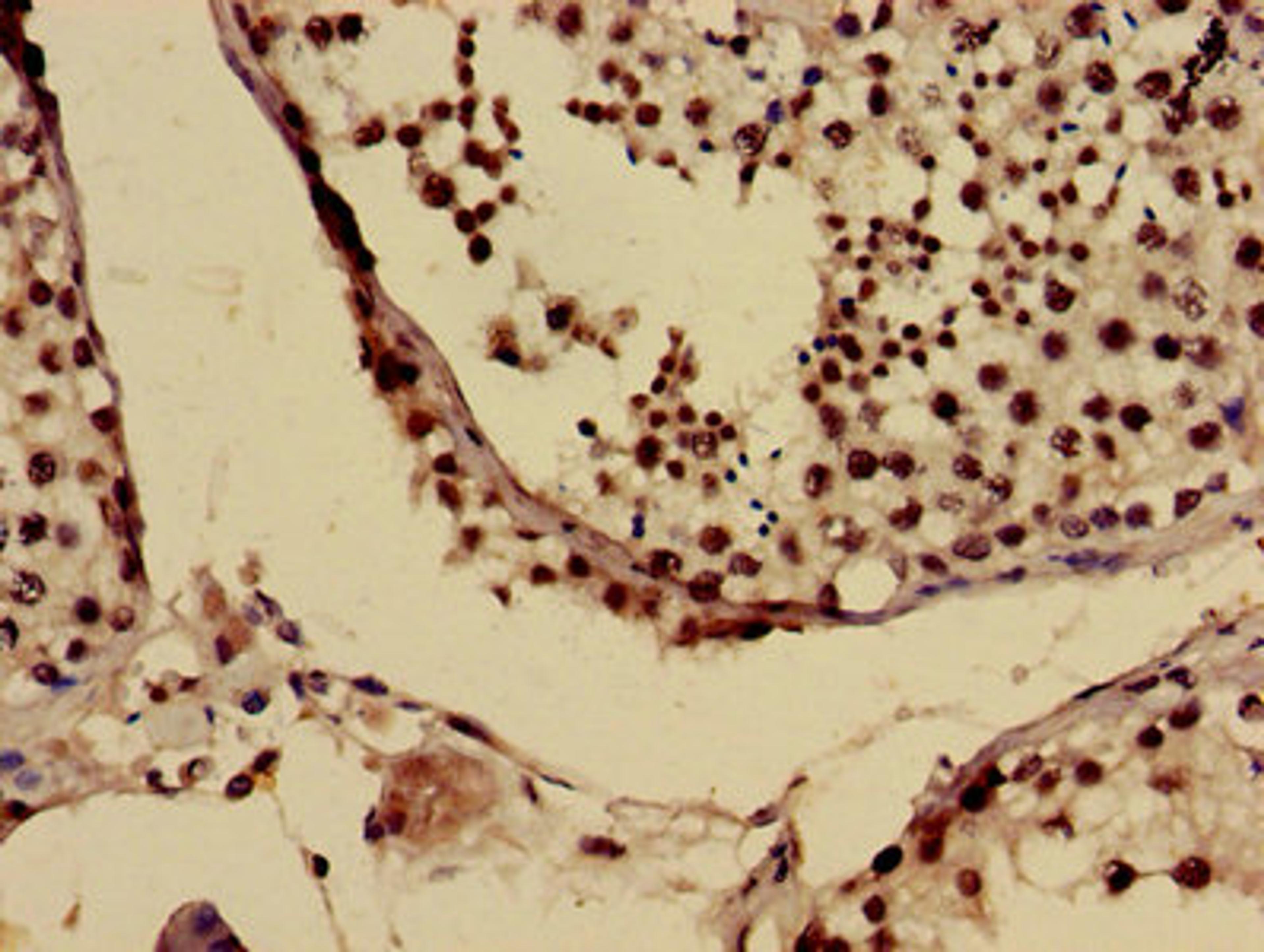 Immunohistochemistry of paraffin-embedded human testis tissue using CSB-PA025694LA01HU at dilution of 1:100