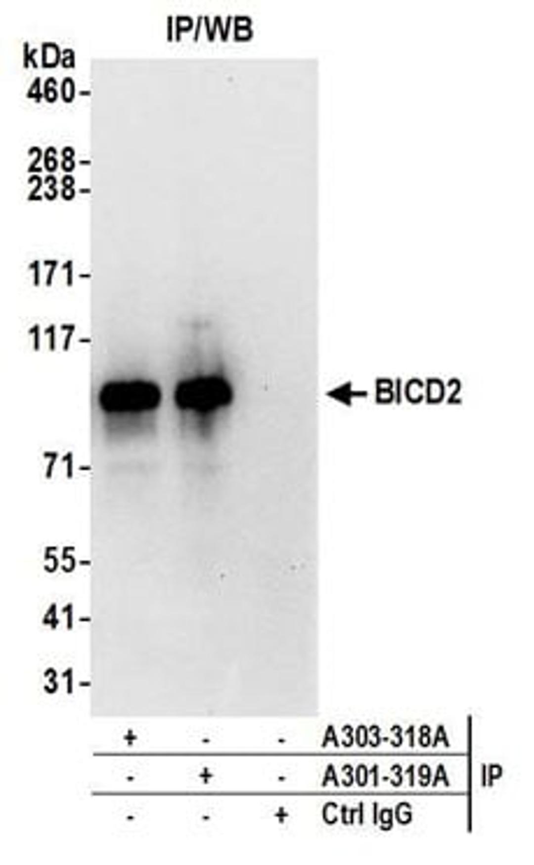 Detection of human BICD2 by western blot of immunoprecipitates.