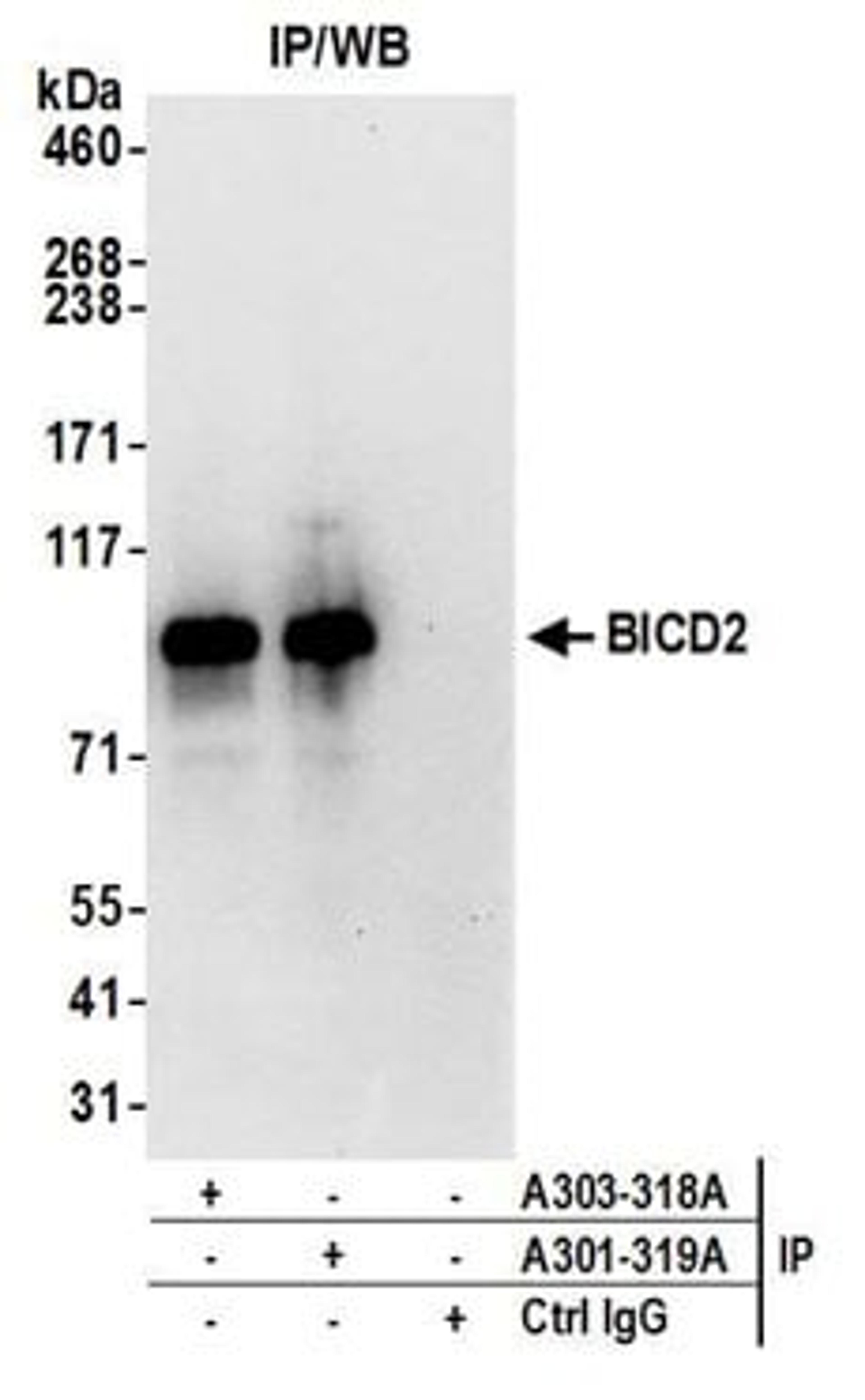 Detection of human BICD2 by western blot of immunoprecipitates.