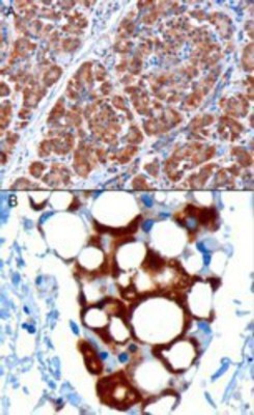 Immunohistochemistry: PDHX Antibody [NB100-1496] - staining of paraffin embedded Human Pancreas. A) Microwaved antigen retrieval with citrate buffer pH 6 (3ug/ml), HRP-staining. B) Microwaved antigen retrieval with Tris/EDTA buffer pH9 (1ug/ml) , HRP-staining.